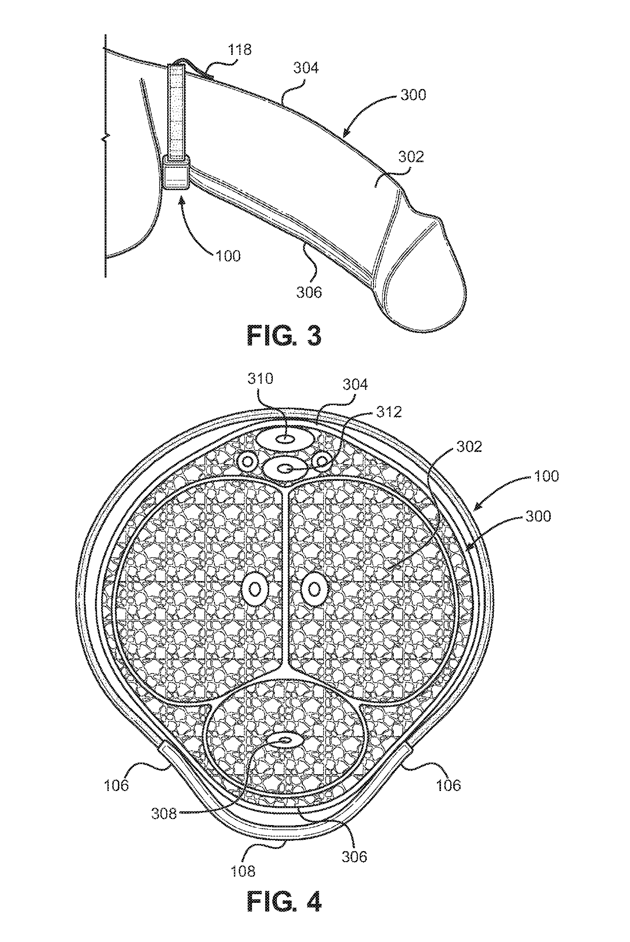 Apparatus for treating erectile dysfunction and enhancing penile enlargement