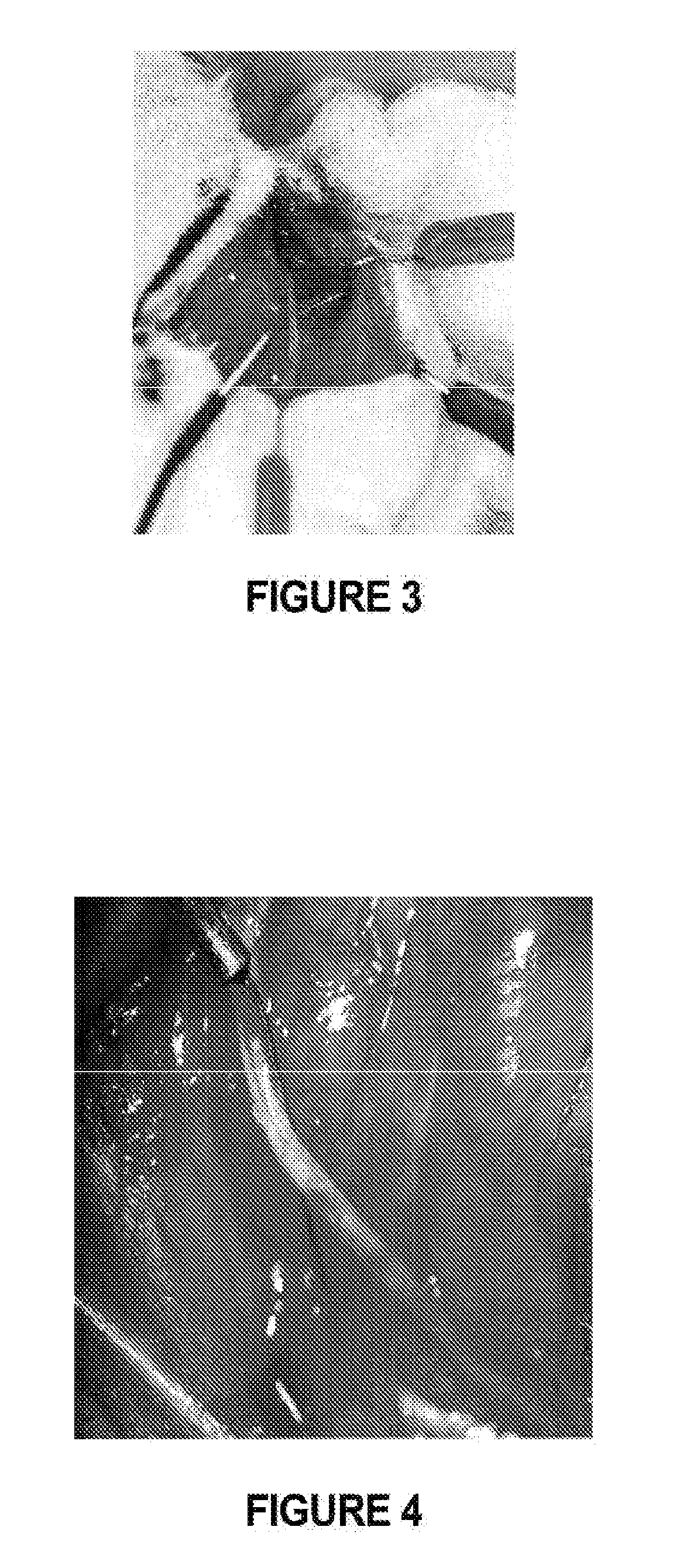 Compositions and methods for treatment of neurological disorders