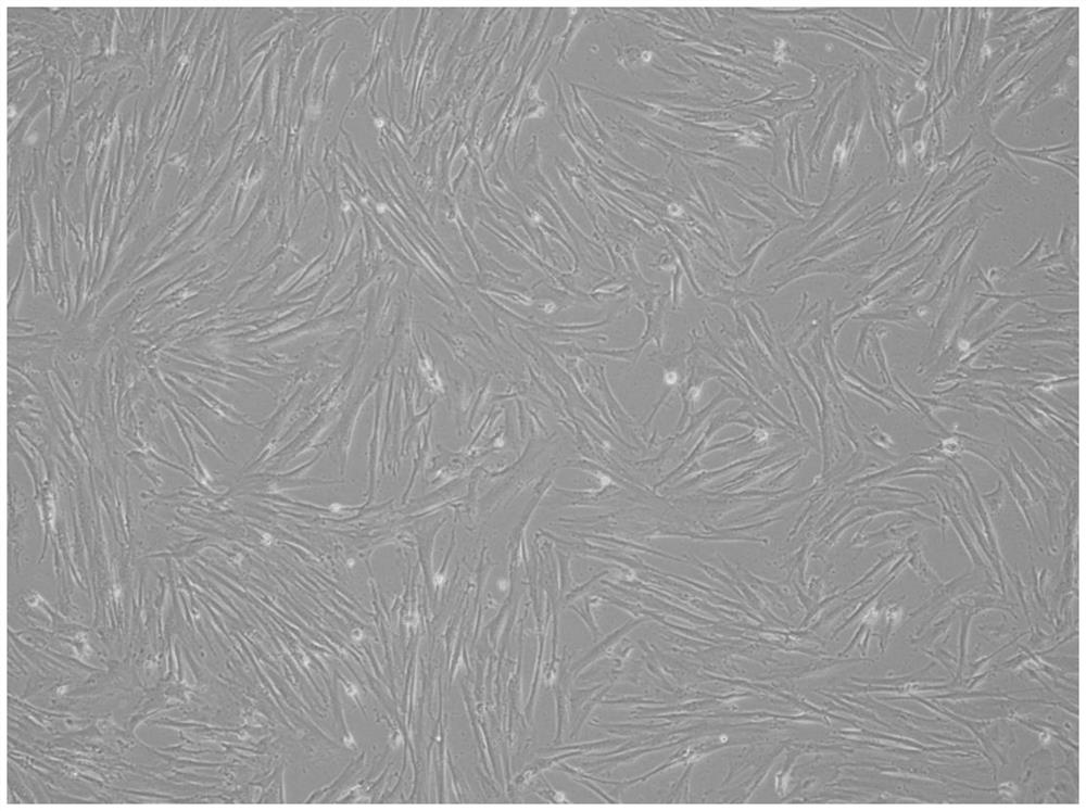 Cryopreservation liquid and cryopreservation method for stem cells and stem cell products