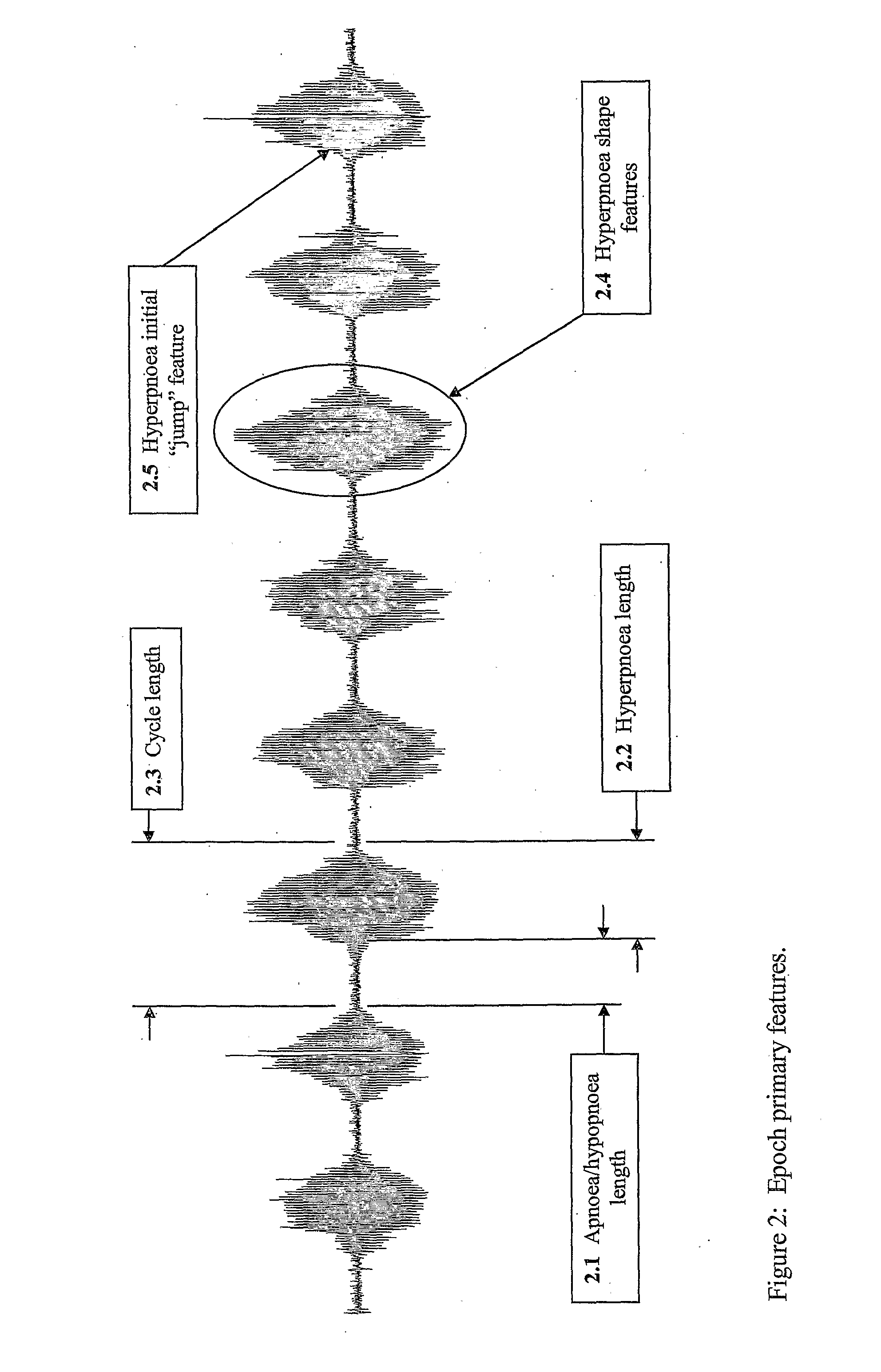 Method For Detecting and Discriminating Breathing Patterns From Respiratory Signals