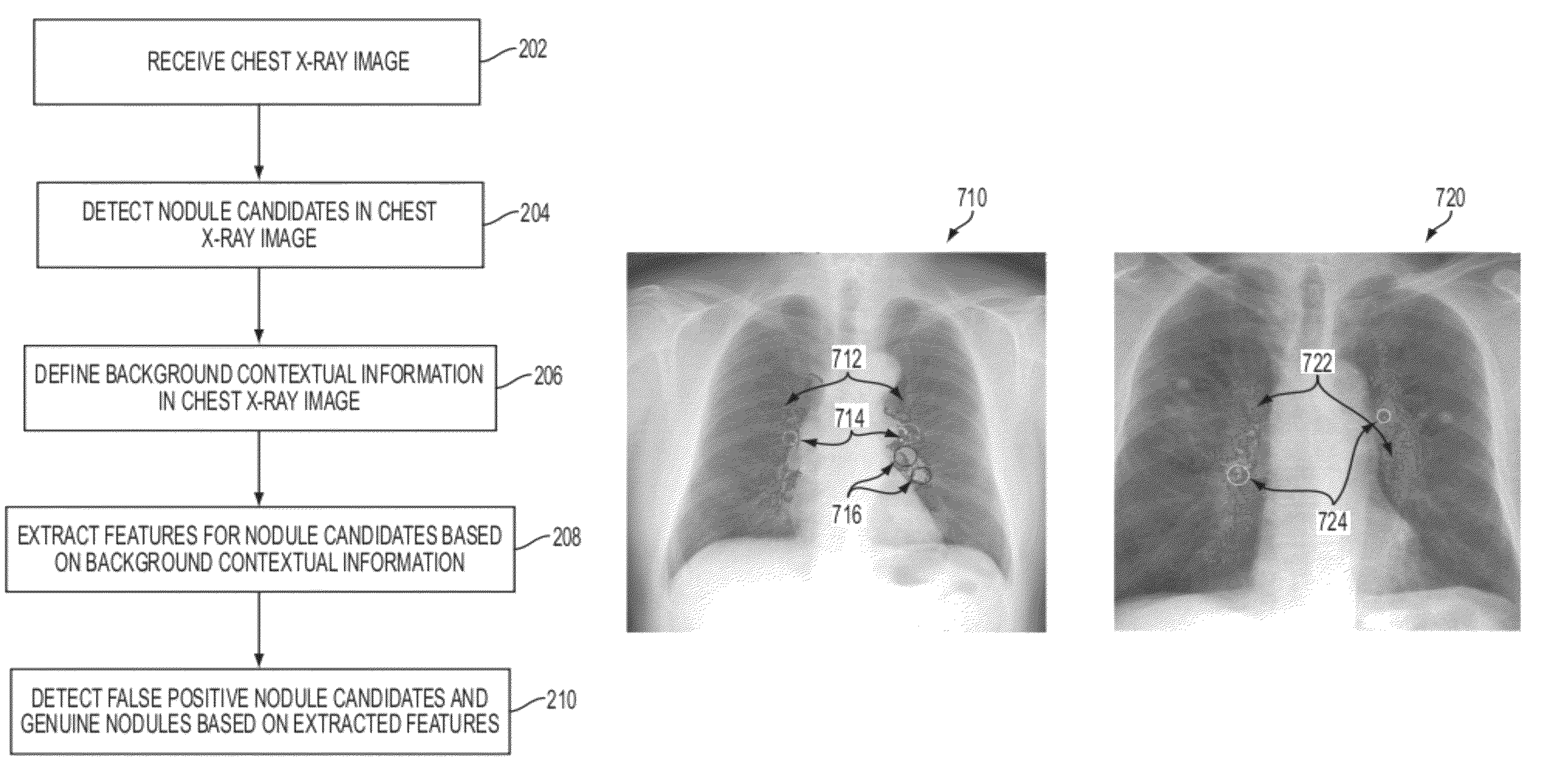 Method and system for nodule feature extraction using background contextual information in chest x-ray images