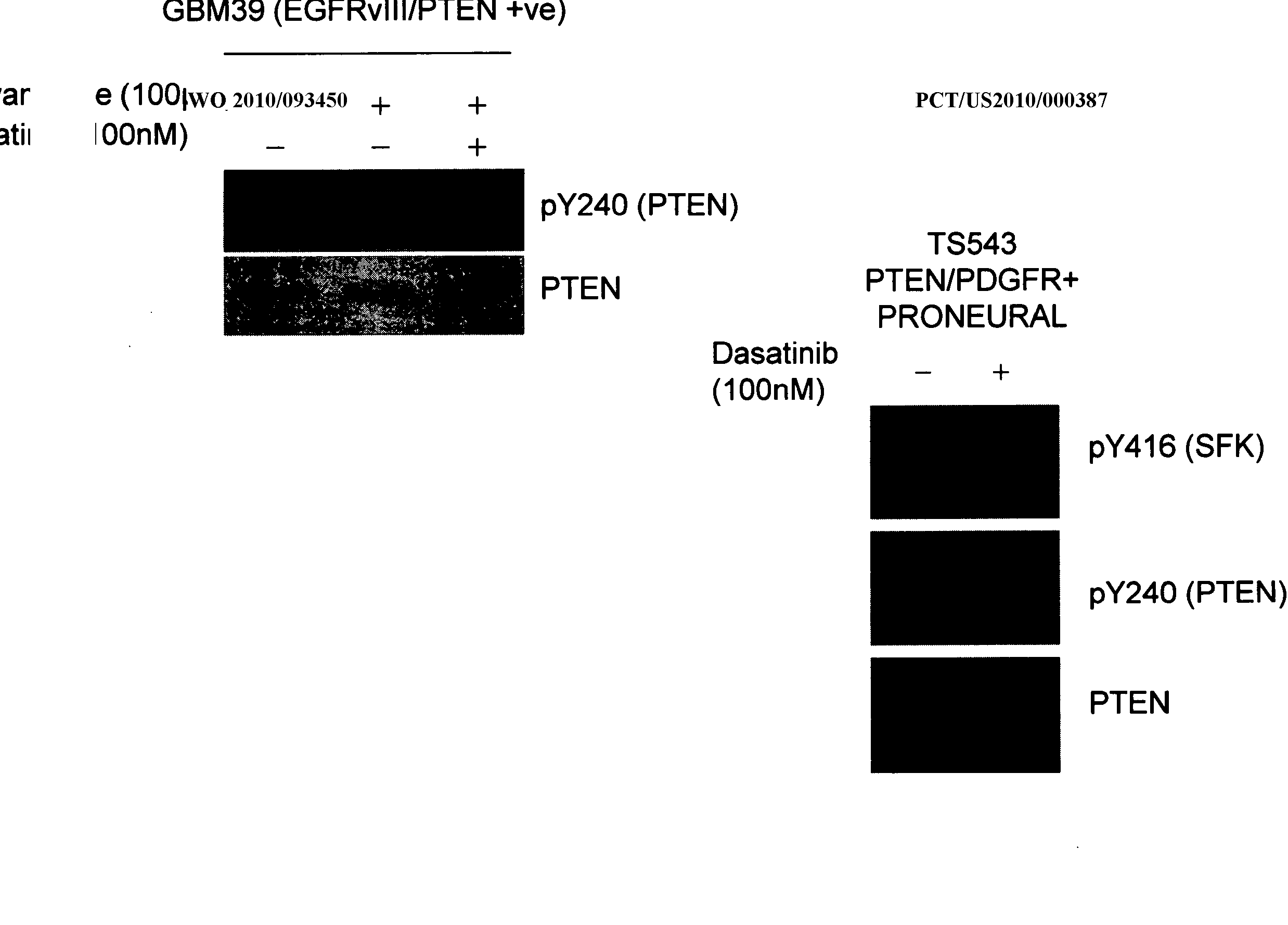 Pten phosphorylation-driven resistance to cancer treatment and altered patient prognosis