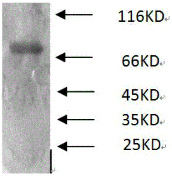 Preparation method and enzyme-linked immunosorbent assay kit of human tumor antigen 3H11Ag
