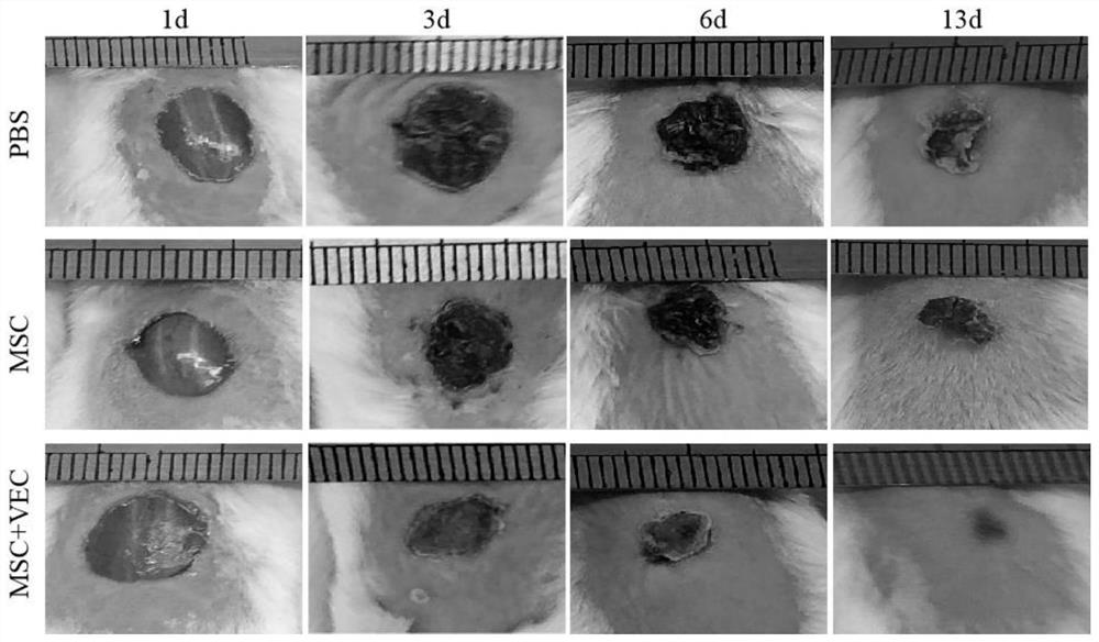 A kind of stem cell composition and its application and stem cell drip