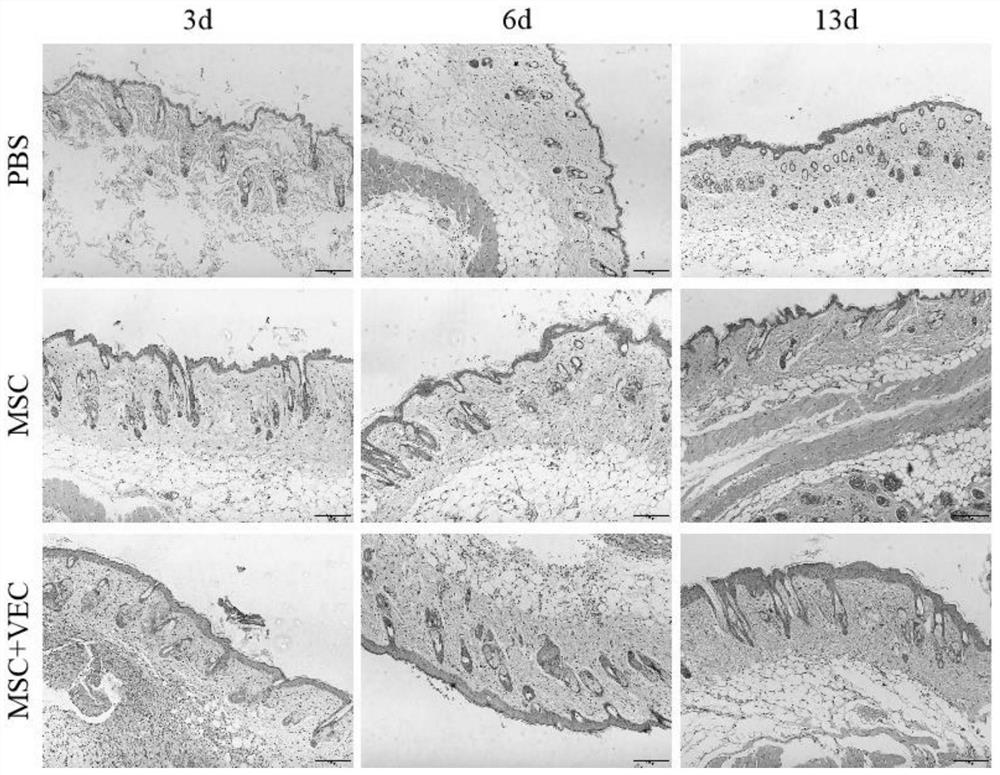 A kind of stem cell composition and its application and stem cell drip