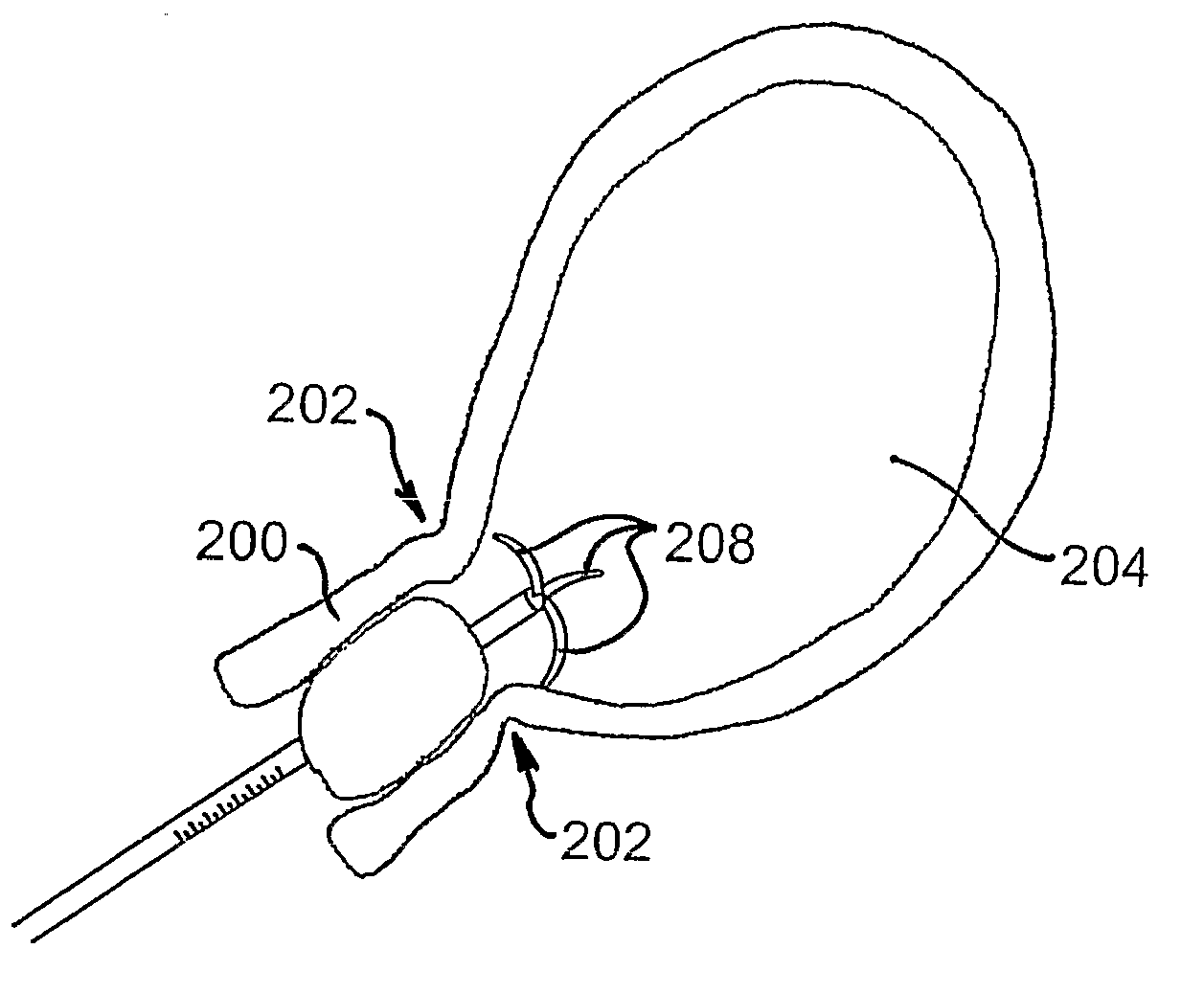 Canal dilation device