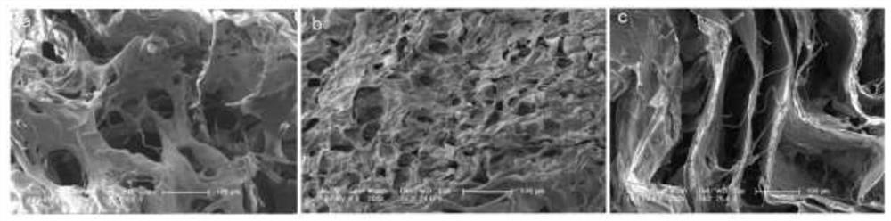 Cytoskeleton, islet cell compound carried by cell cytoskeleton, preparation method and application