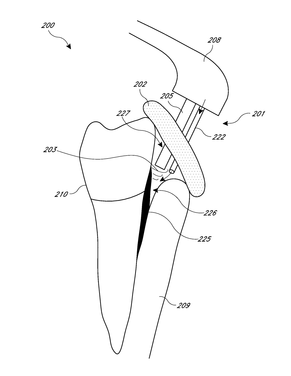 Apparatus and methods for cleaning teeth and gingival pockets