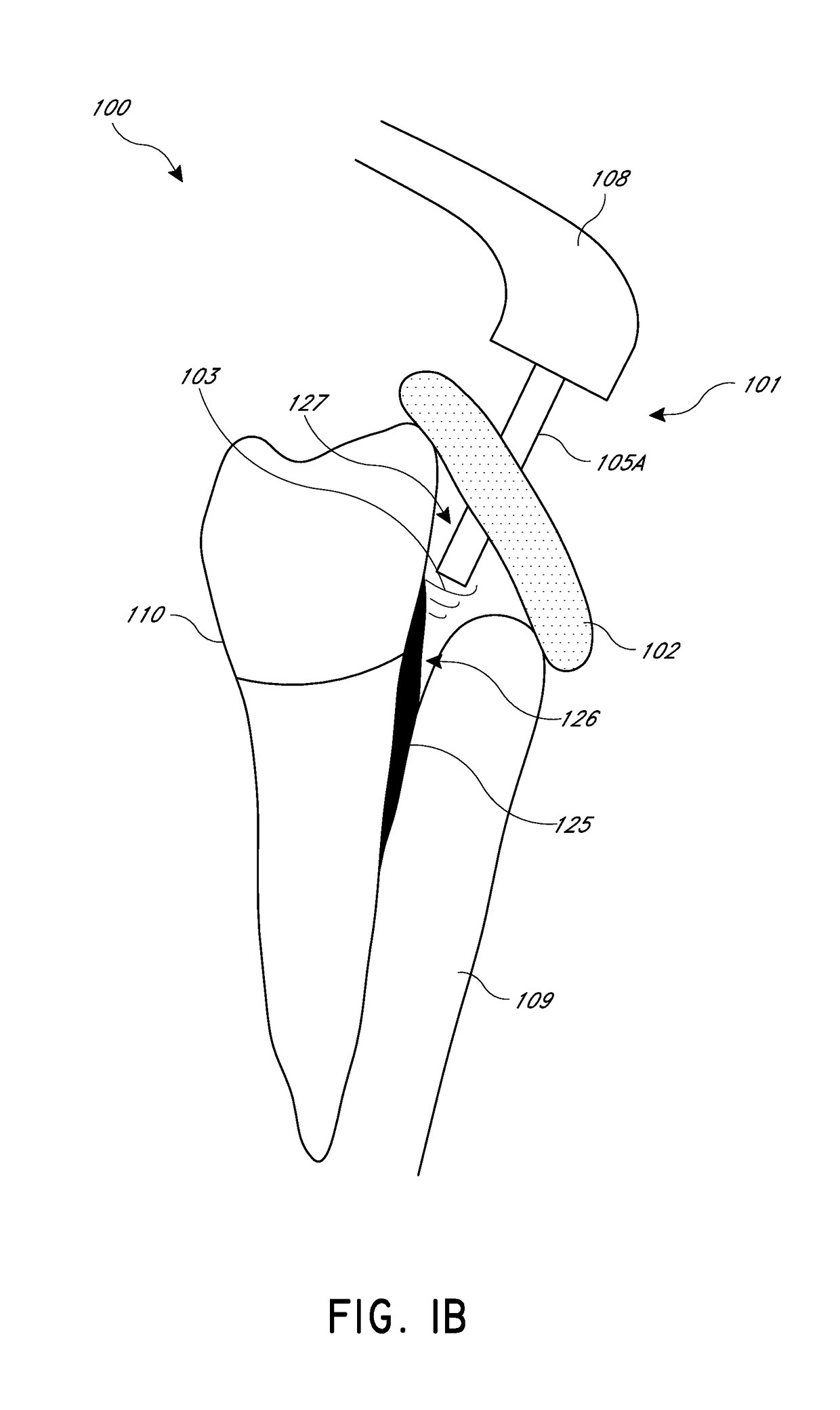 Apparatus and methods for cleaning teeth and gingival pockets