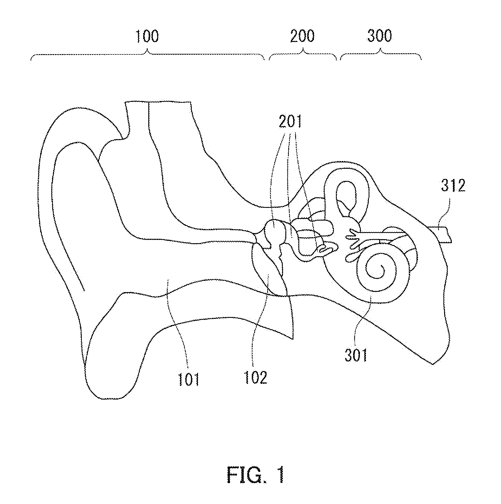 Artificial sensory epithelium