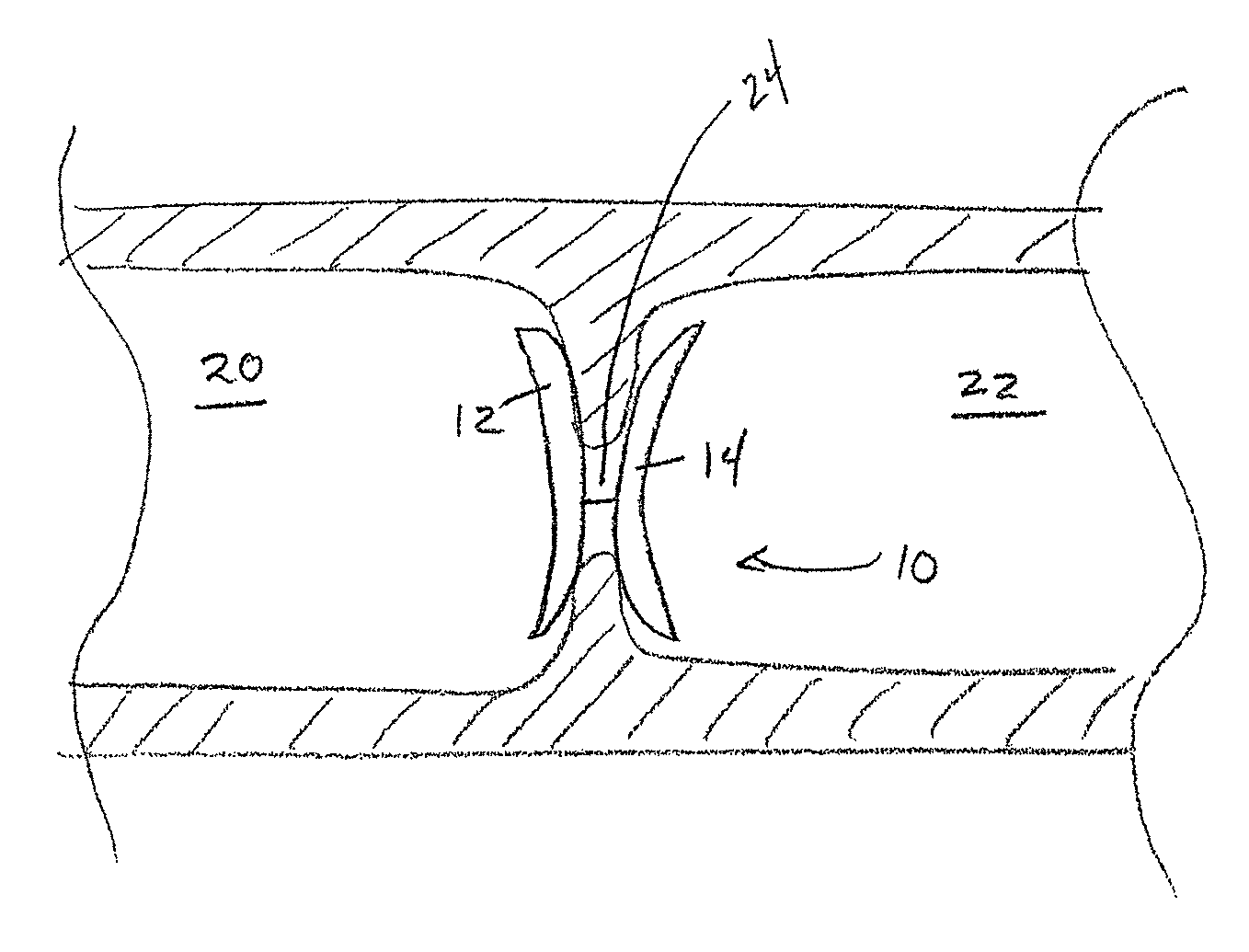 Intracardiac implant for delivery of alarmins and methods thereof