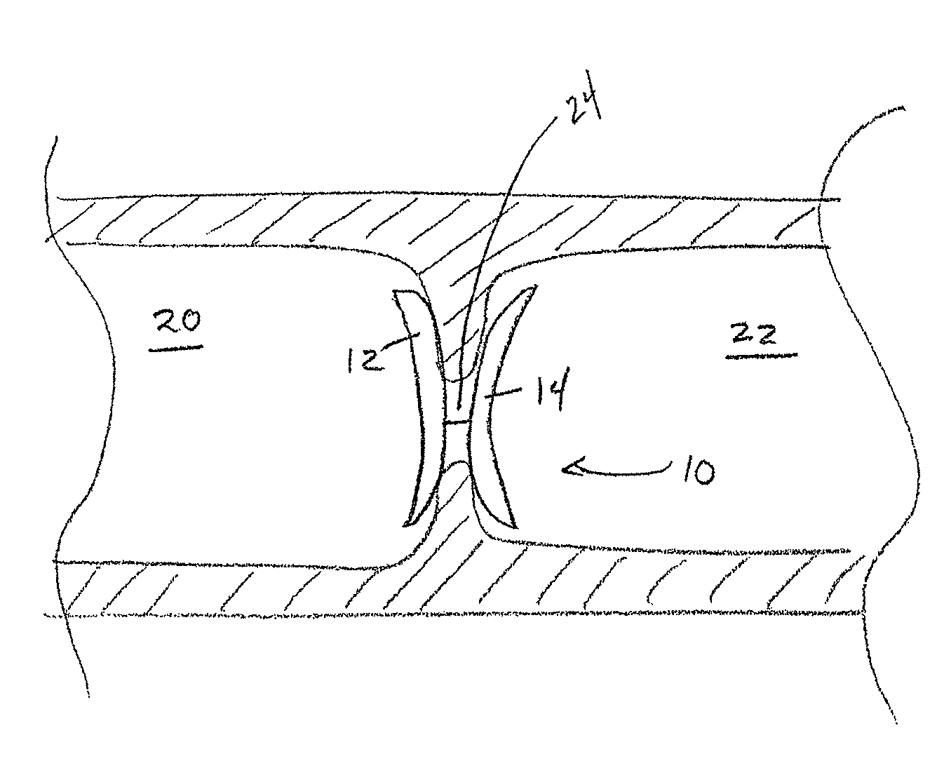 Intracardiac implant for delivery of alarmins and methods thereof