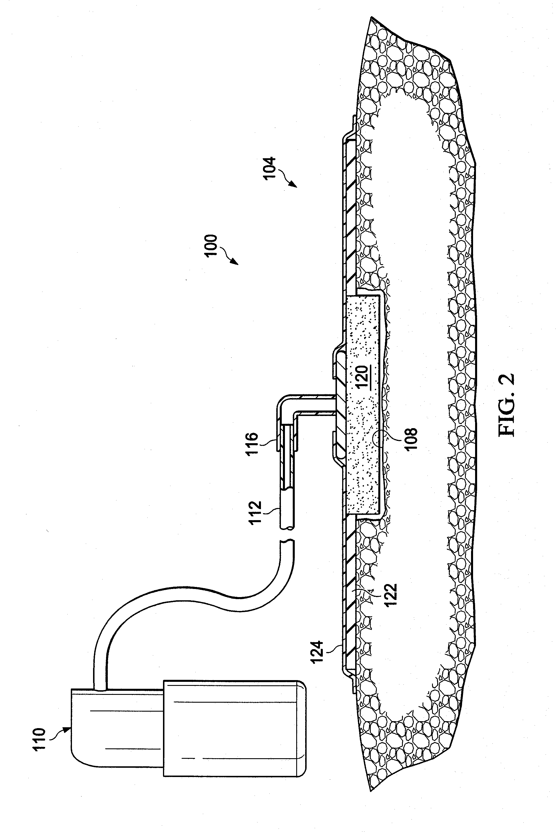 Manually powered, regulated, negative pressure pump with adapter for external pressure source