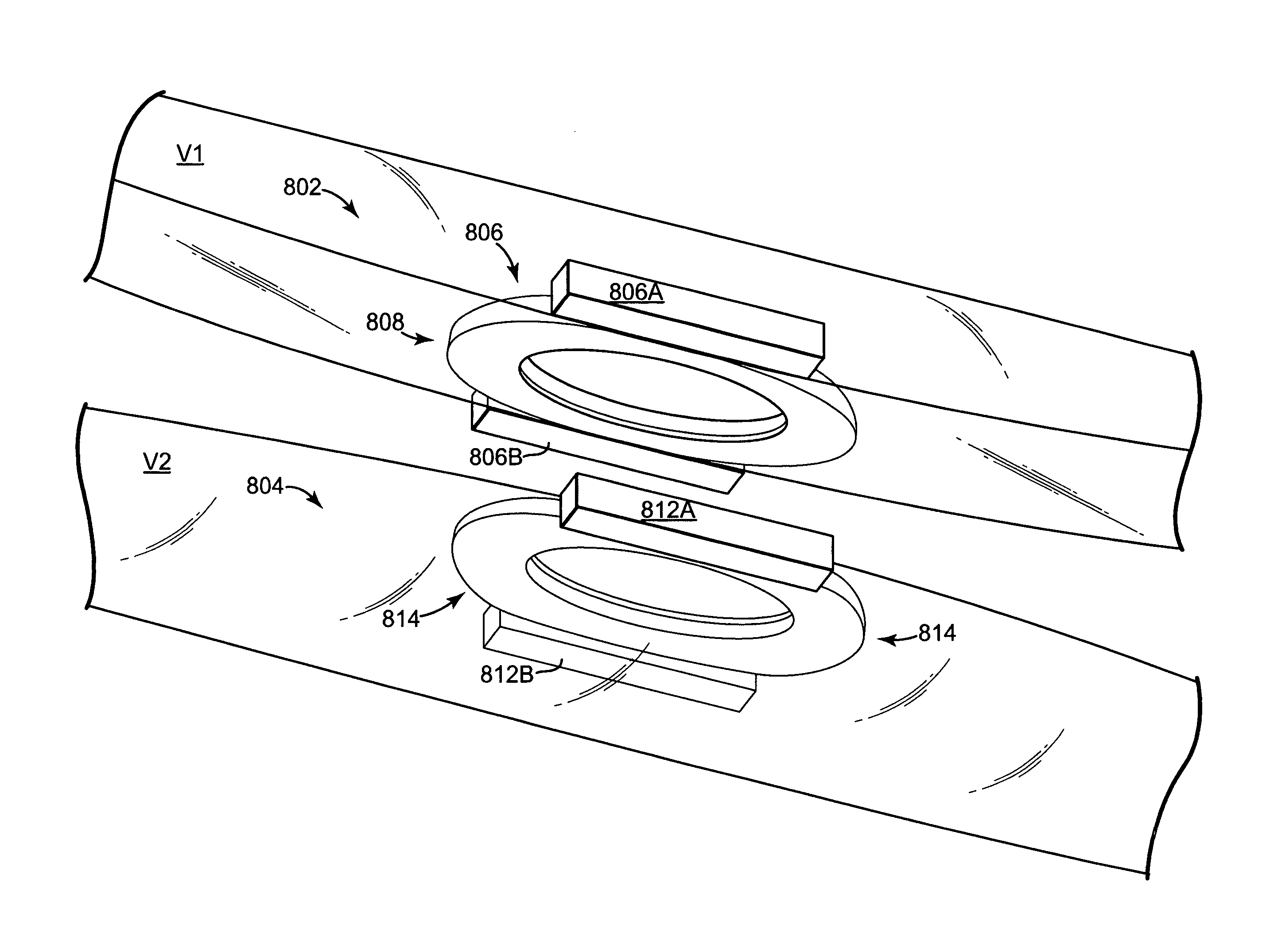 Devices and methods for forming magnetic anastomoses between vessels
