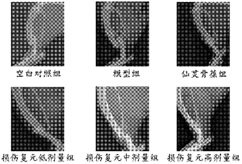 Traditional Chinese medicine composition used for treating fractures, preparation method thereof, and application thereof