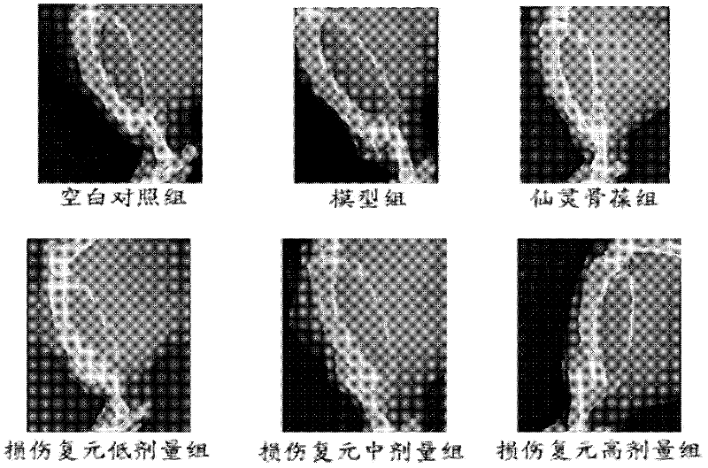 Traditional Chinese medicine composition used for treating fractures, preparation method thereof, and application thereof