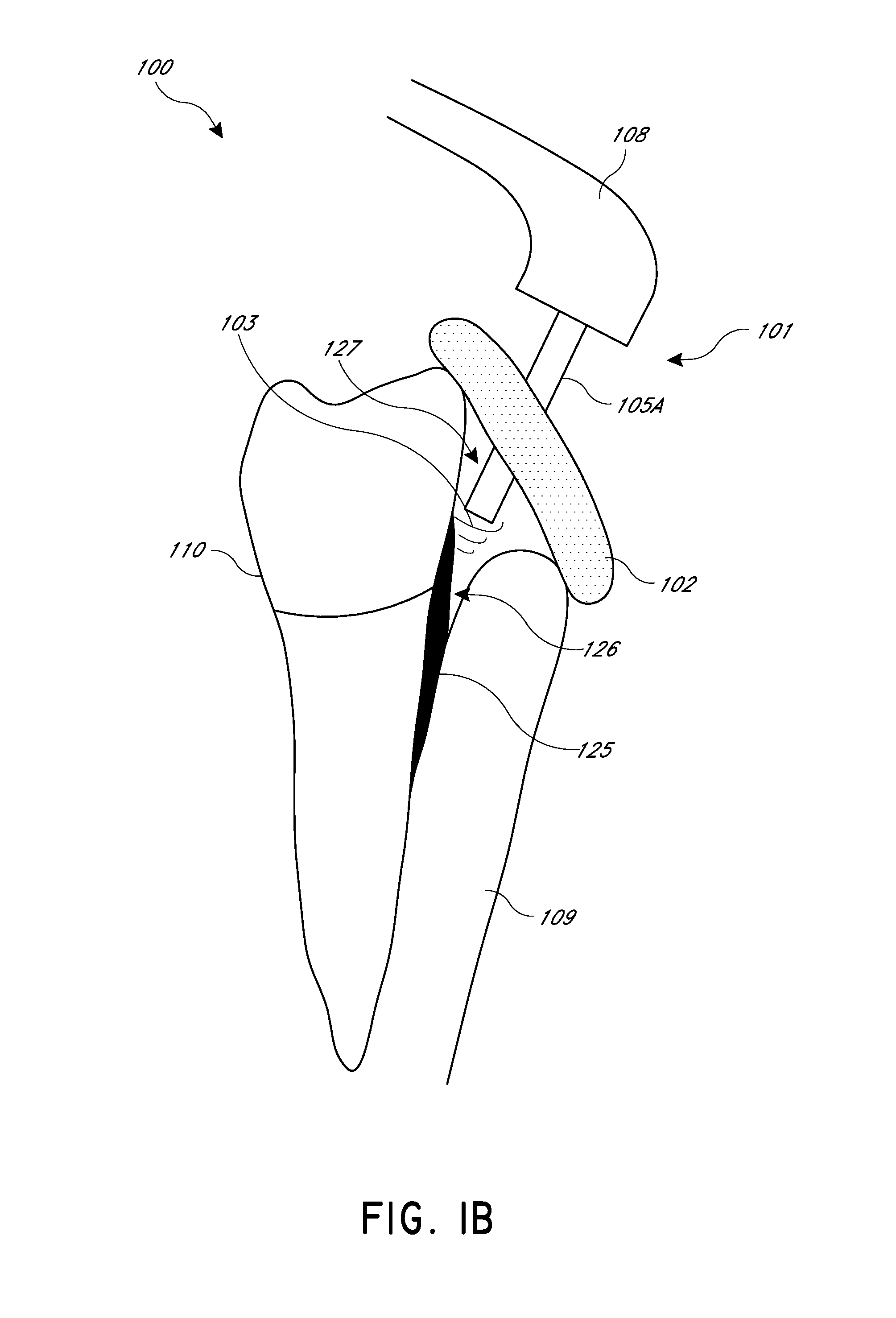 Apparatus and methods for cleaning teeth and gingival pockets
