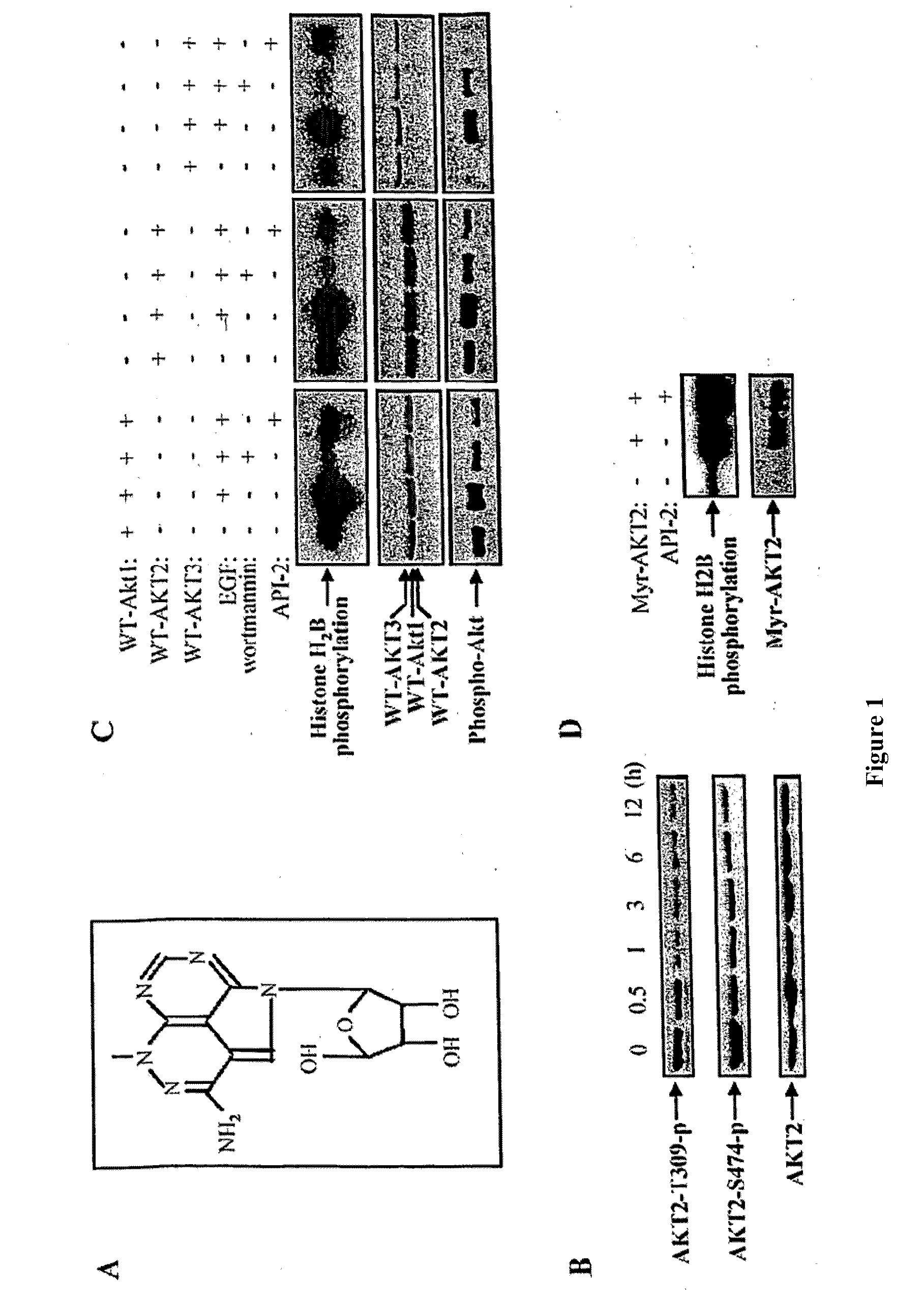 Effective treatment of esophogeal adenocarcinoma using triciribine and related compounds