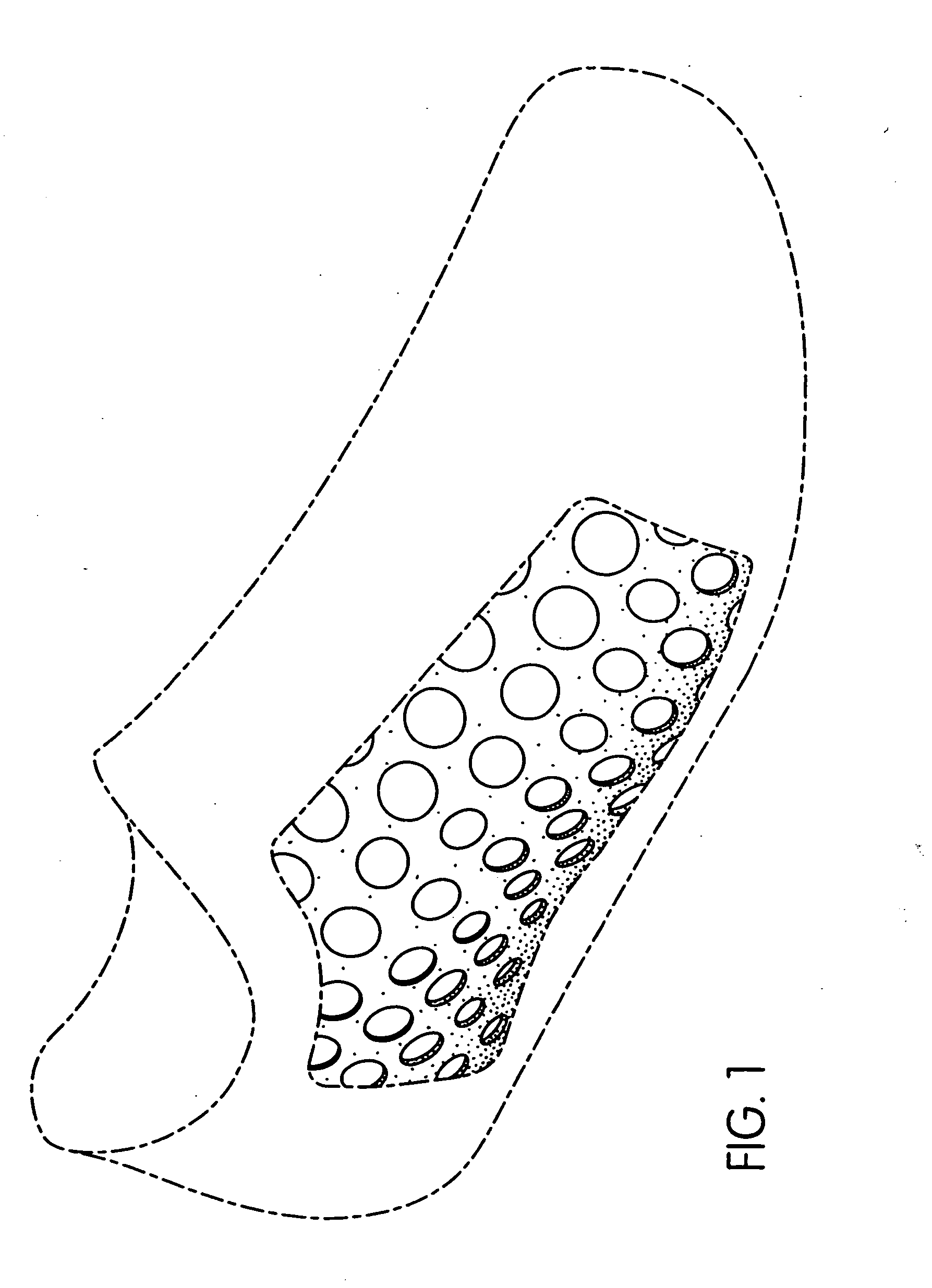Article of footwear with perforated covering and removable components