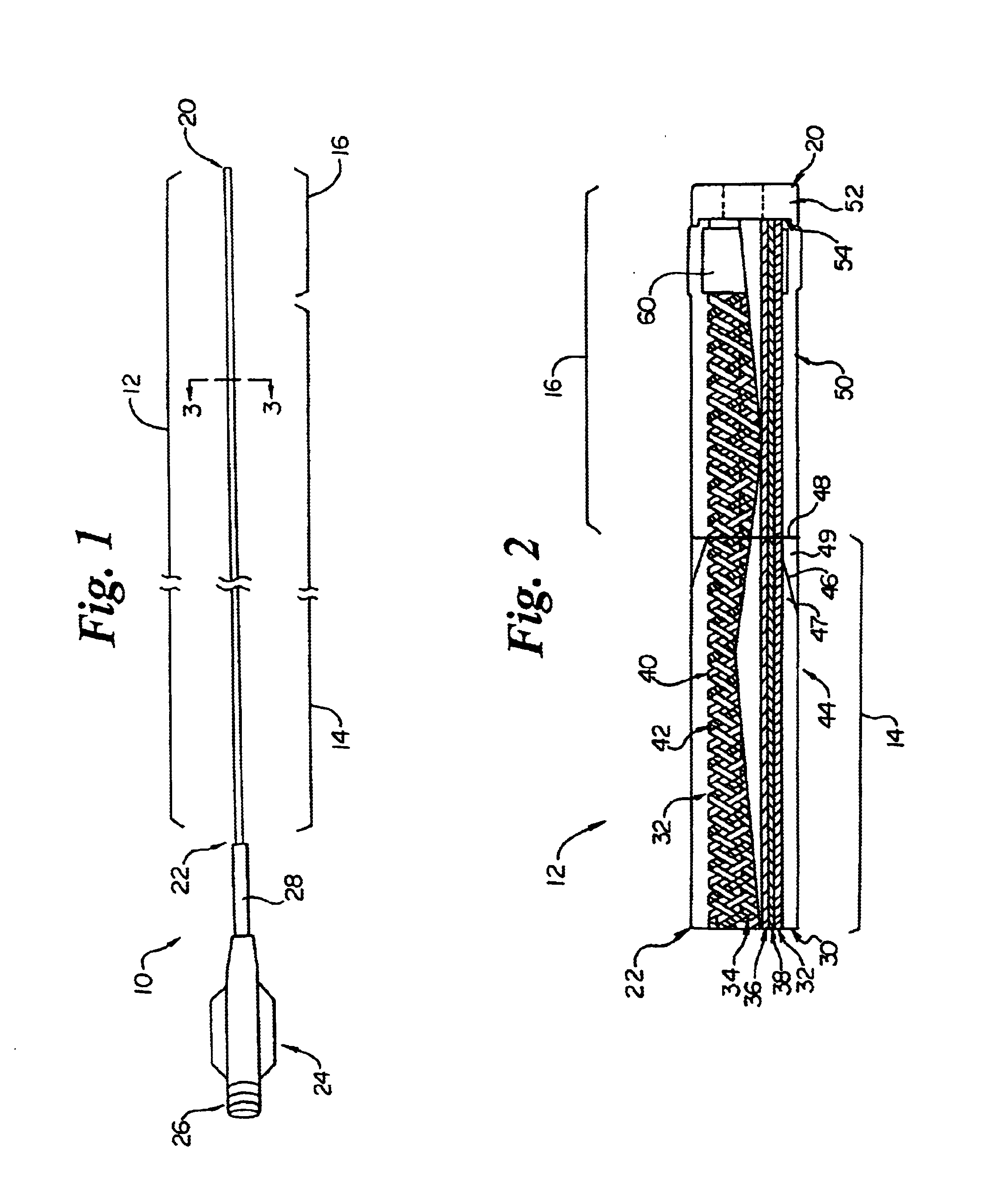 Intravascular catheter with composite reinforcement