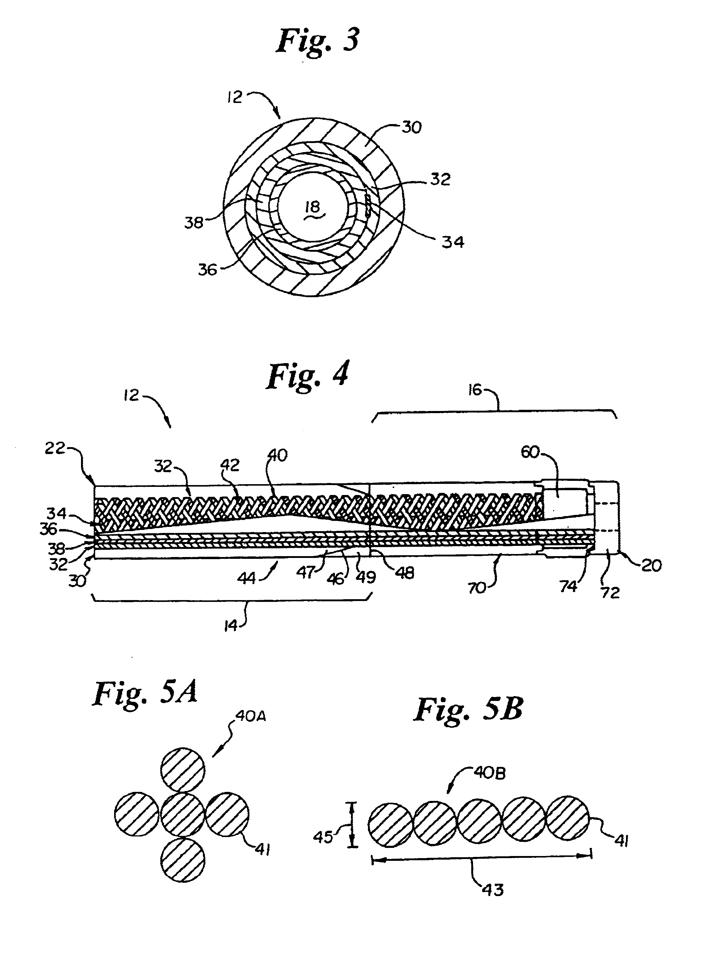 Intravascular catheter with composite reinforcement