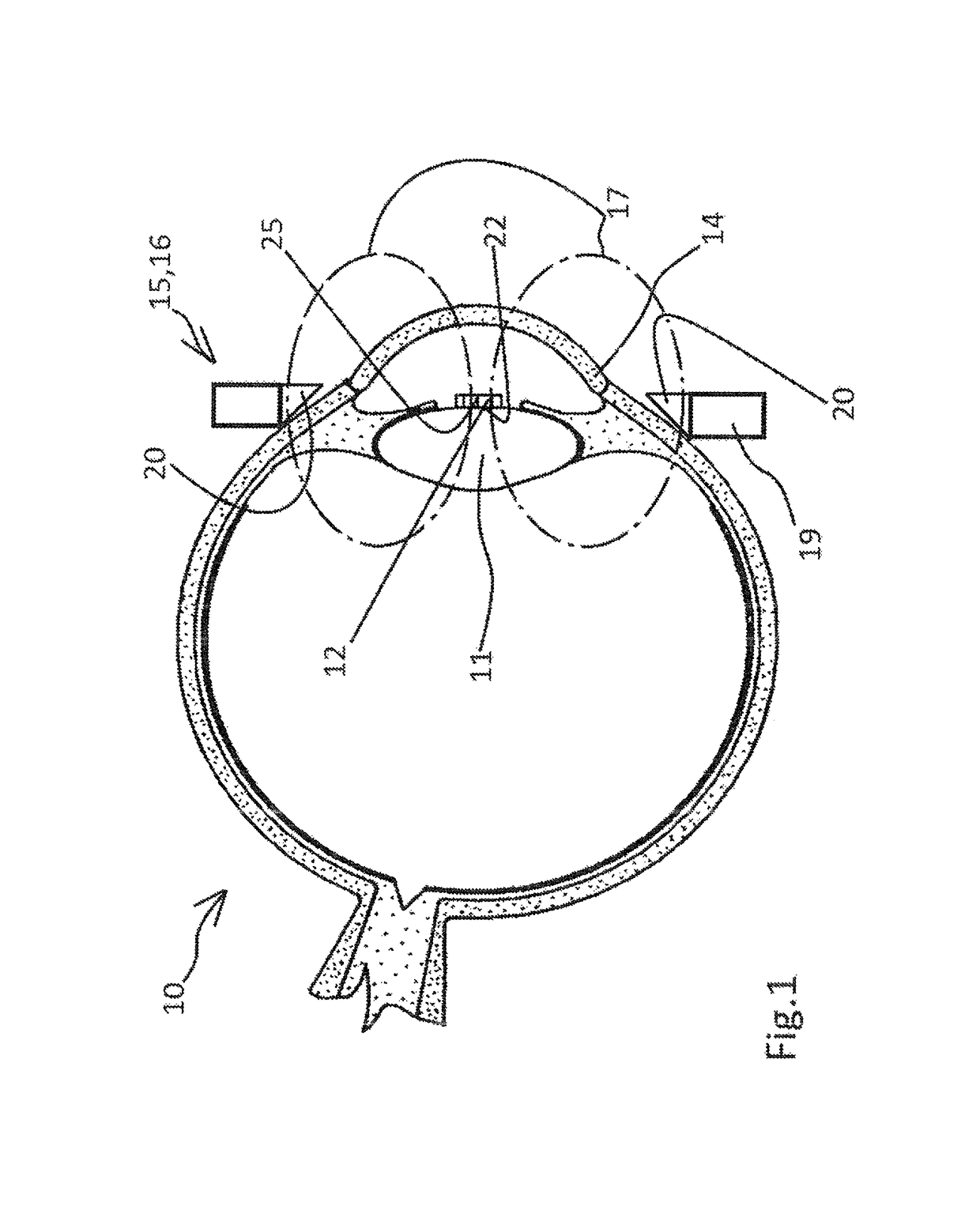 Device for producing cuts or perforations on an eye