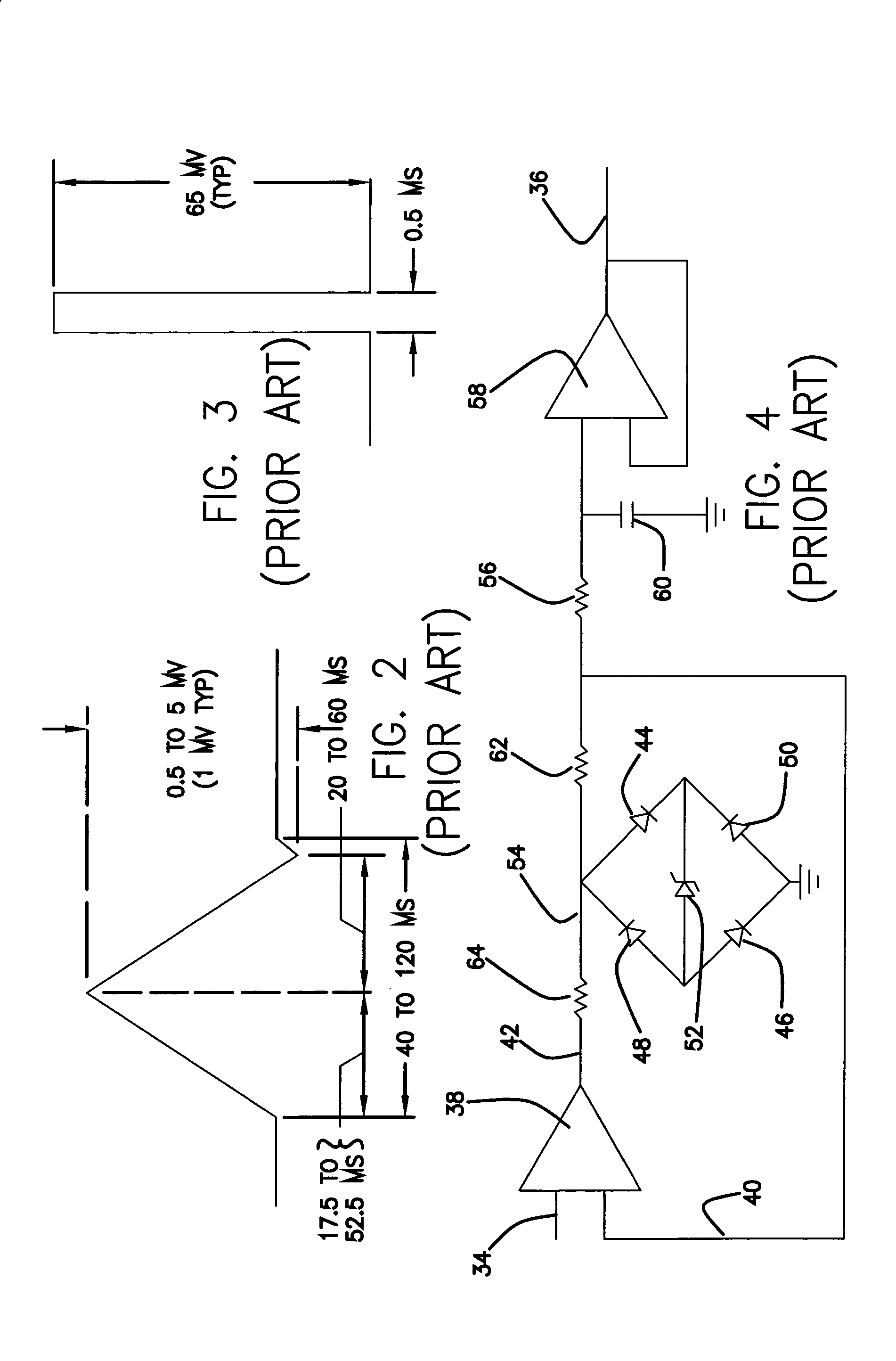 Apparatus and method for removing magnetic resonance imaging-induced noise from ECG signals