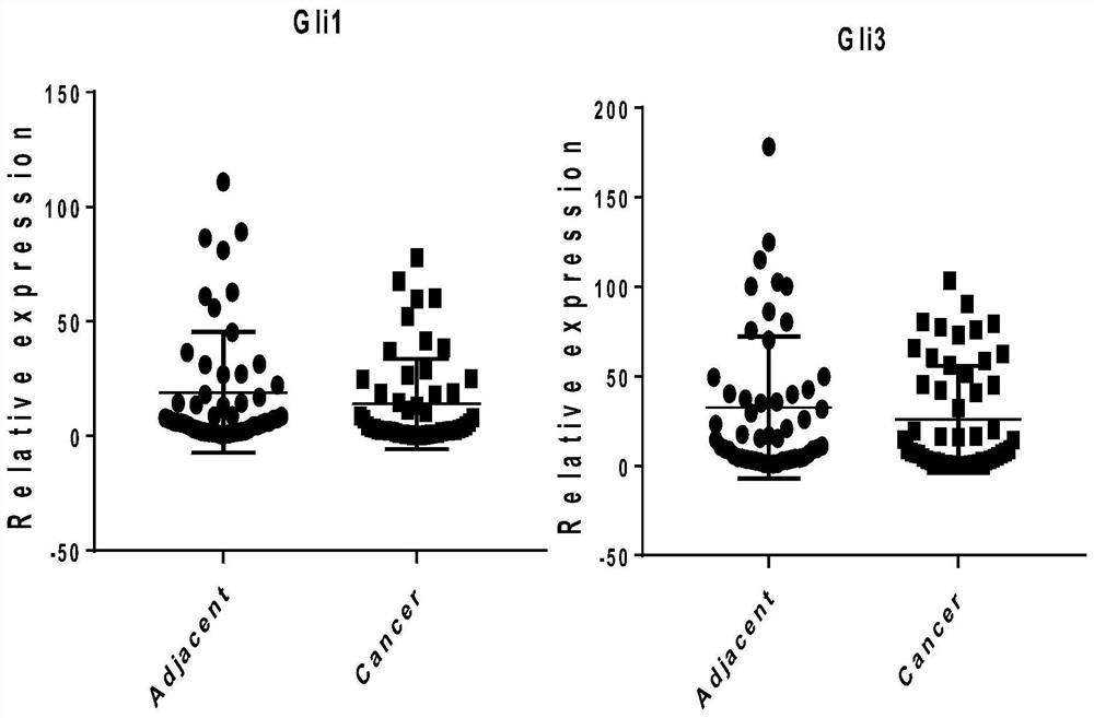 GLI protein inhibitor and application thereof