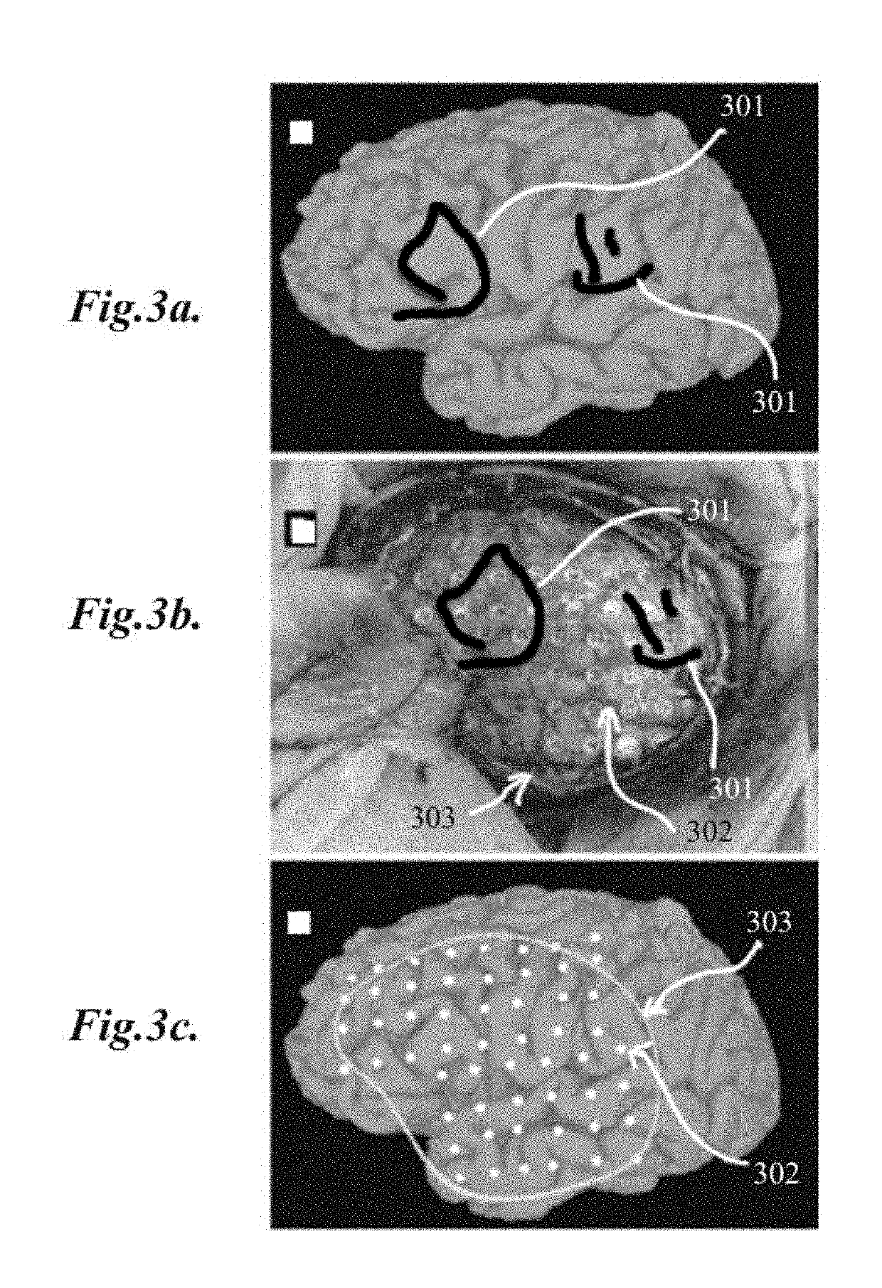 Methods for localization and visualization of electrodes and probes in the brain using anatomical mesh models