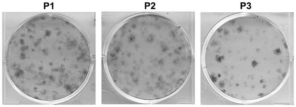 A combined use of HFDSPCS-CM and HA to promote diabetic wound healing