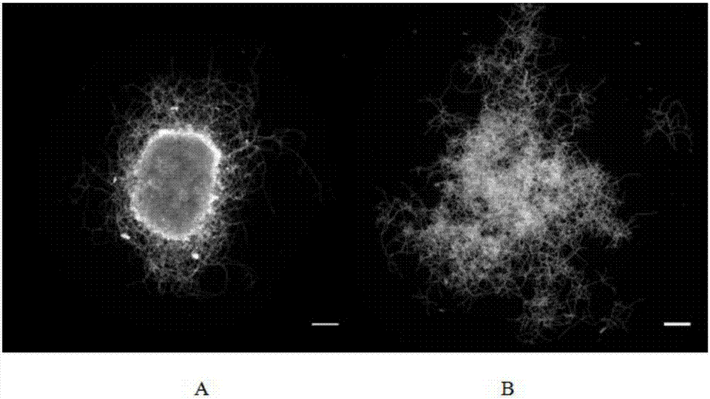 Method for controlling mycelial morphology of Neurospora crassa and increasing output of cellulase