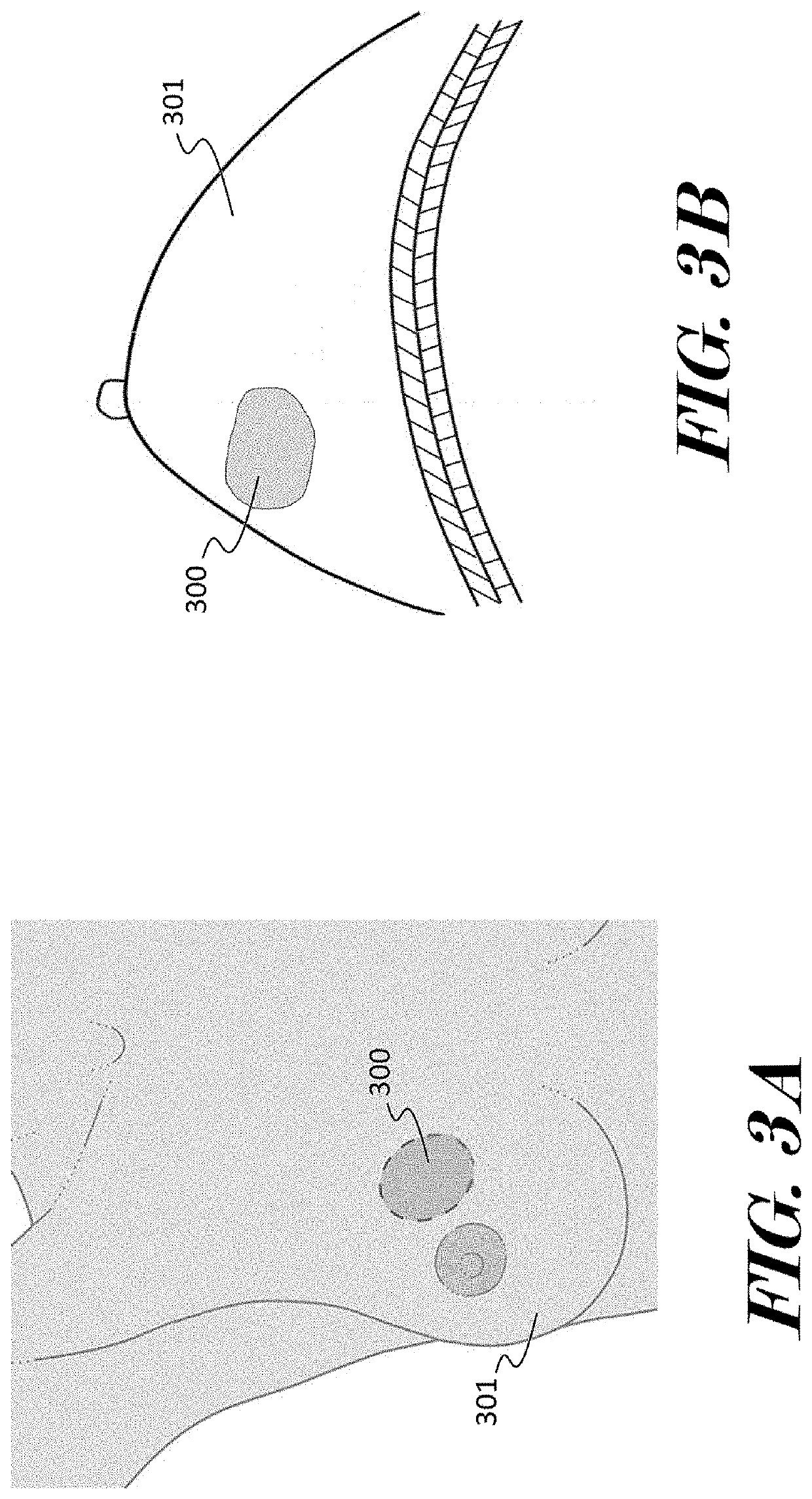 Method for precision cancer treatment by identifying drug resistance
