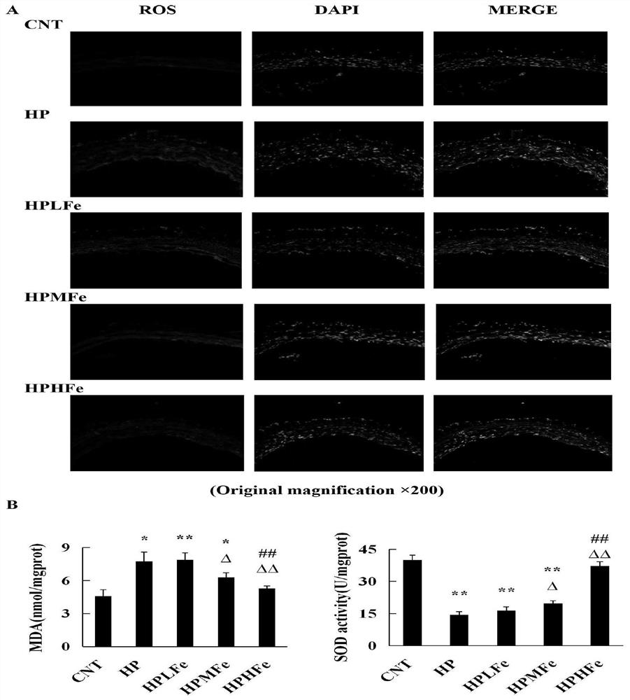 Application of iron sucrose in preparation of medicine for treating hyperphosphatemia-induced vascular calcification