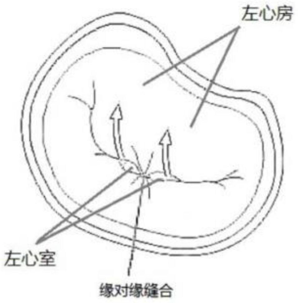 Transcatheter heart valve clamping system