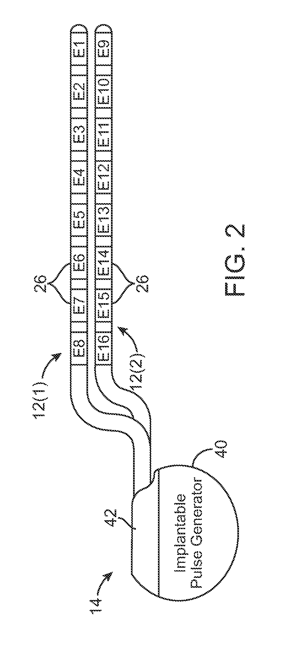 System and method for modulating action potential propagation during spinal cord stimulation