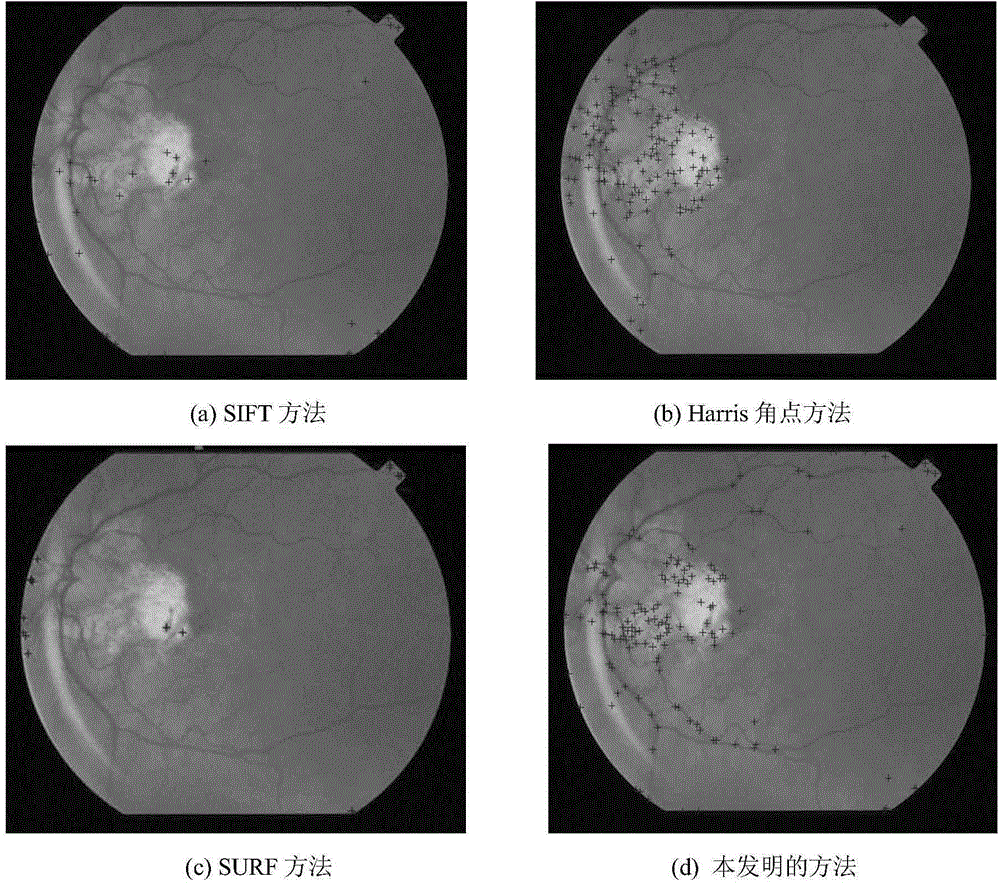 Registration method applied to retina fundus image