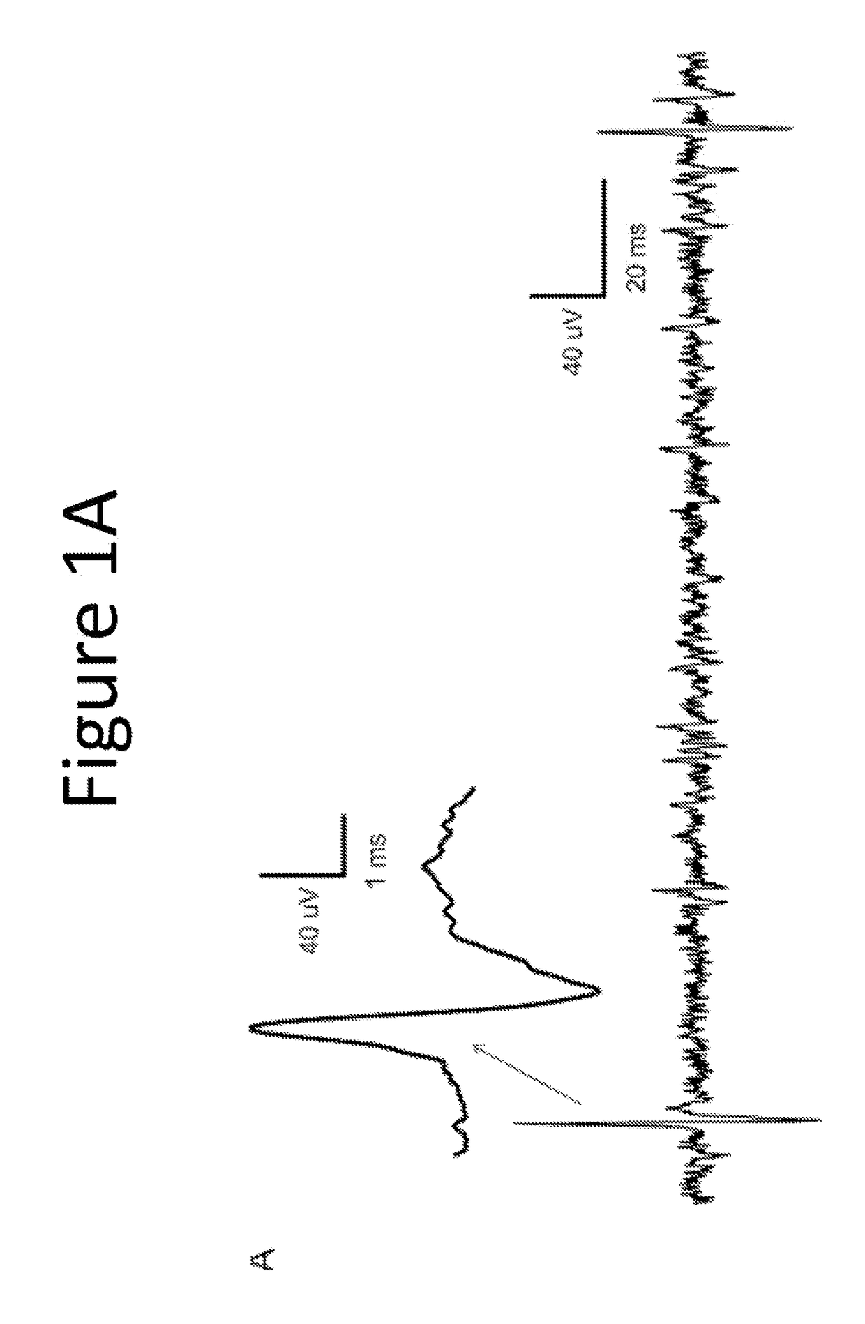 Methods of treating and preventing gastrointestinal motility disorders using aminosterols