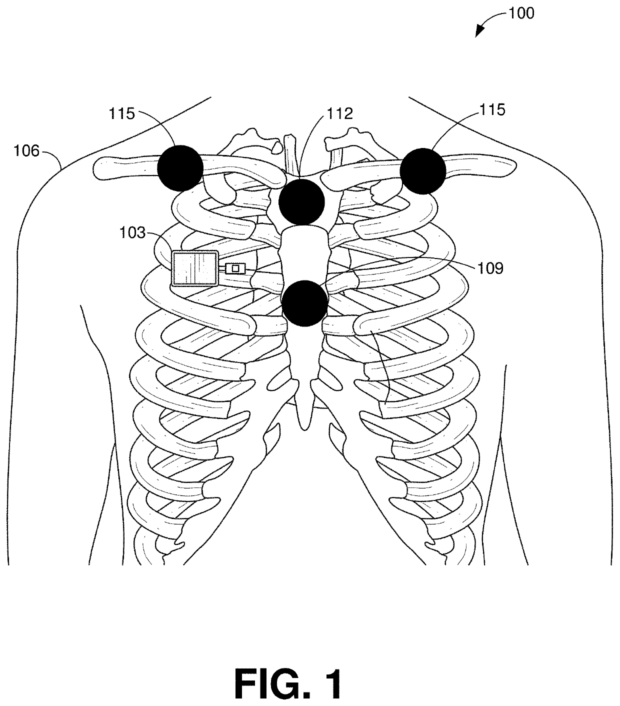 Patch for improved biometric data capture and related processes