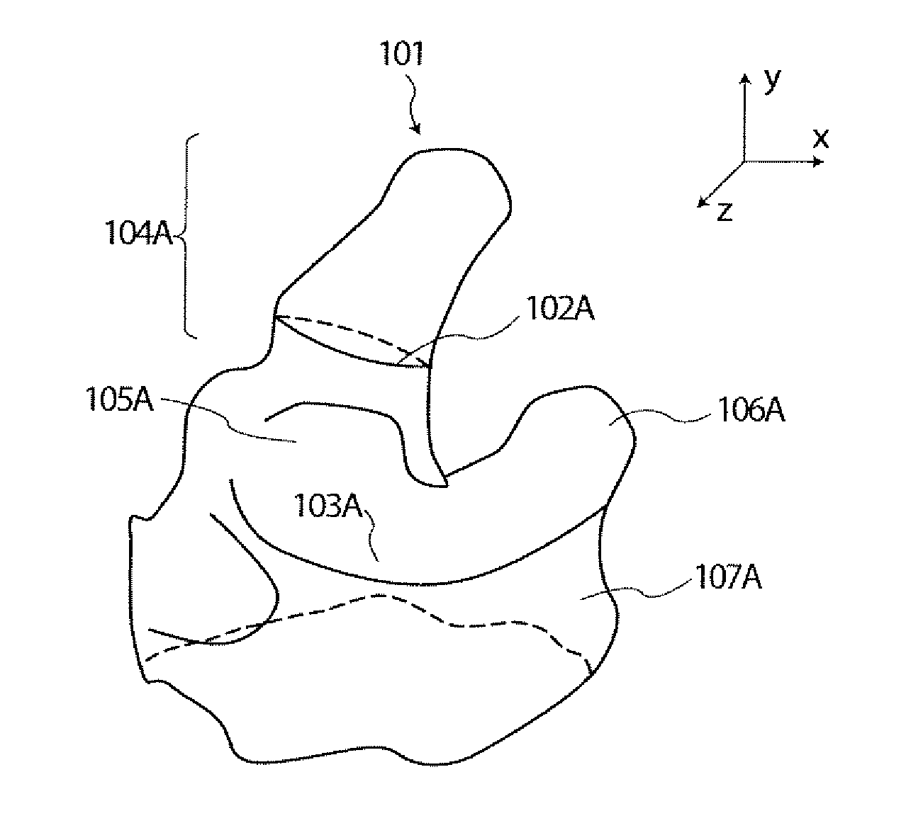 Method and Apparatus for the Classification of Surface Features of an Ear Impression