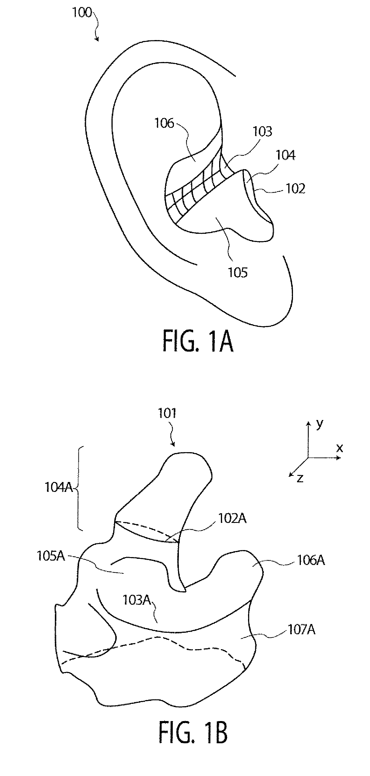 Method and Apparatus for the Classification of Surface Features of an Ear Impression