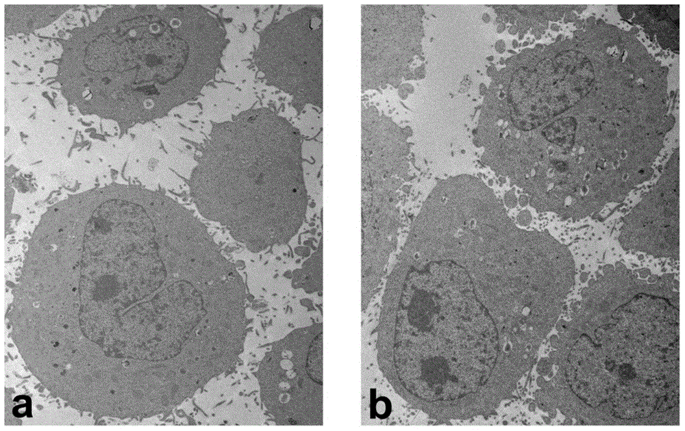 Bacterial ghost preparation method of independent lysis gene E