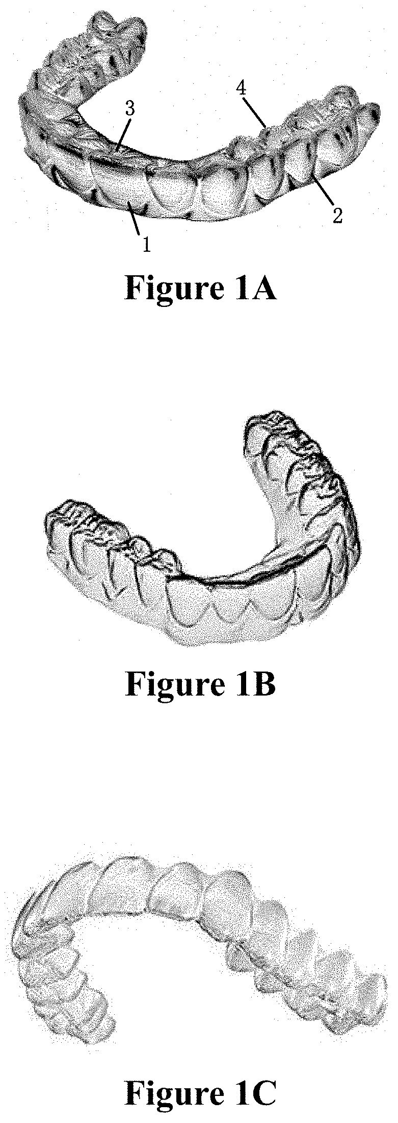 Dental tray and use thereof