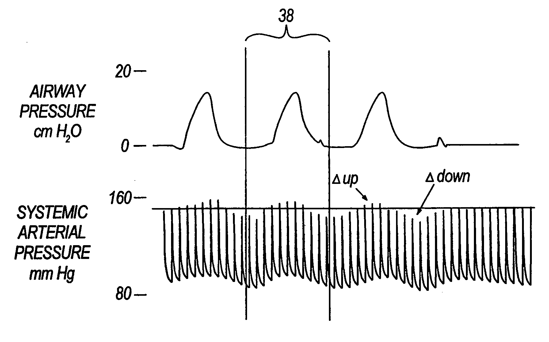 System and method of monitoring systolic pressure variation