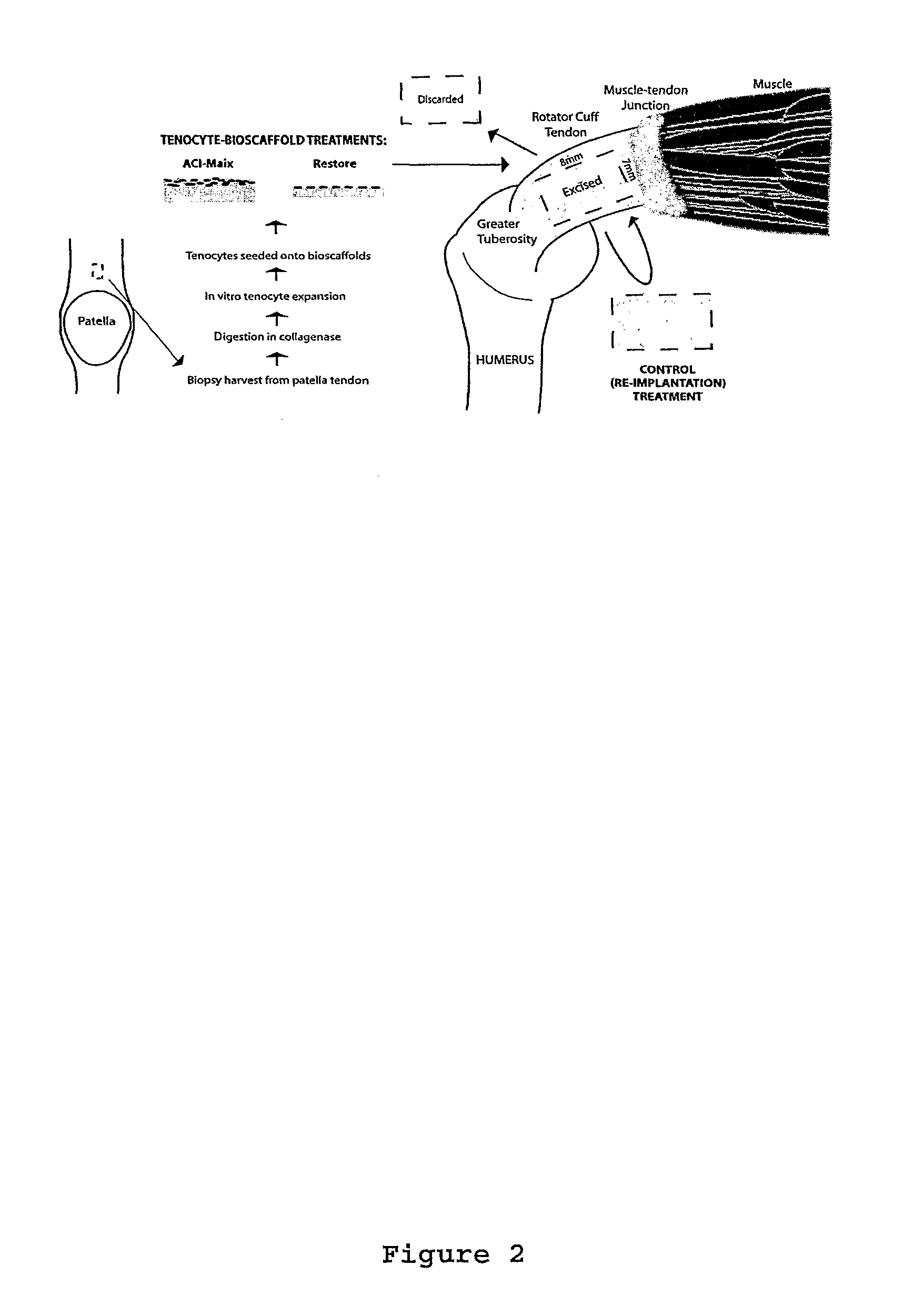 Tenocyte containing bioscaffolds and treatment using the same