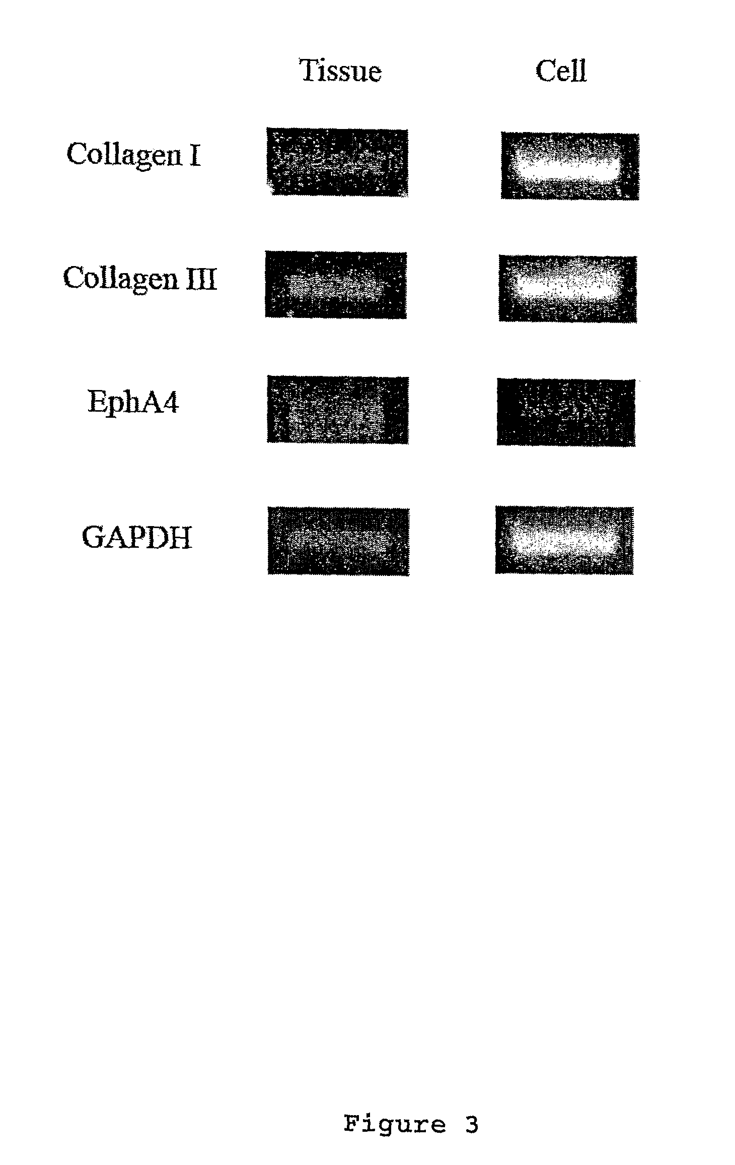 Tenocyte containing bioscaffolds and treatment using the same