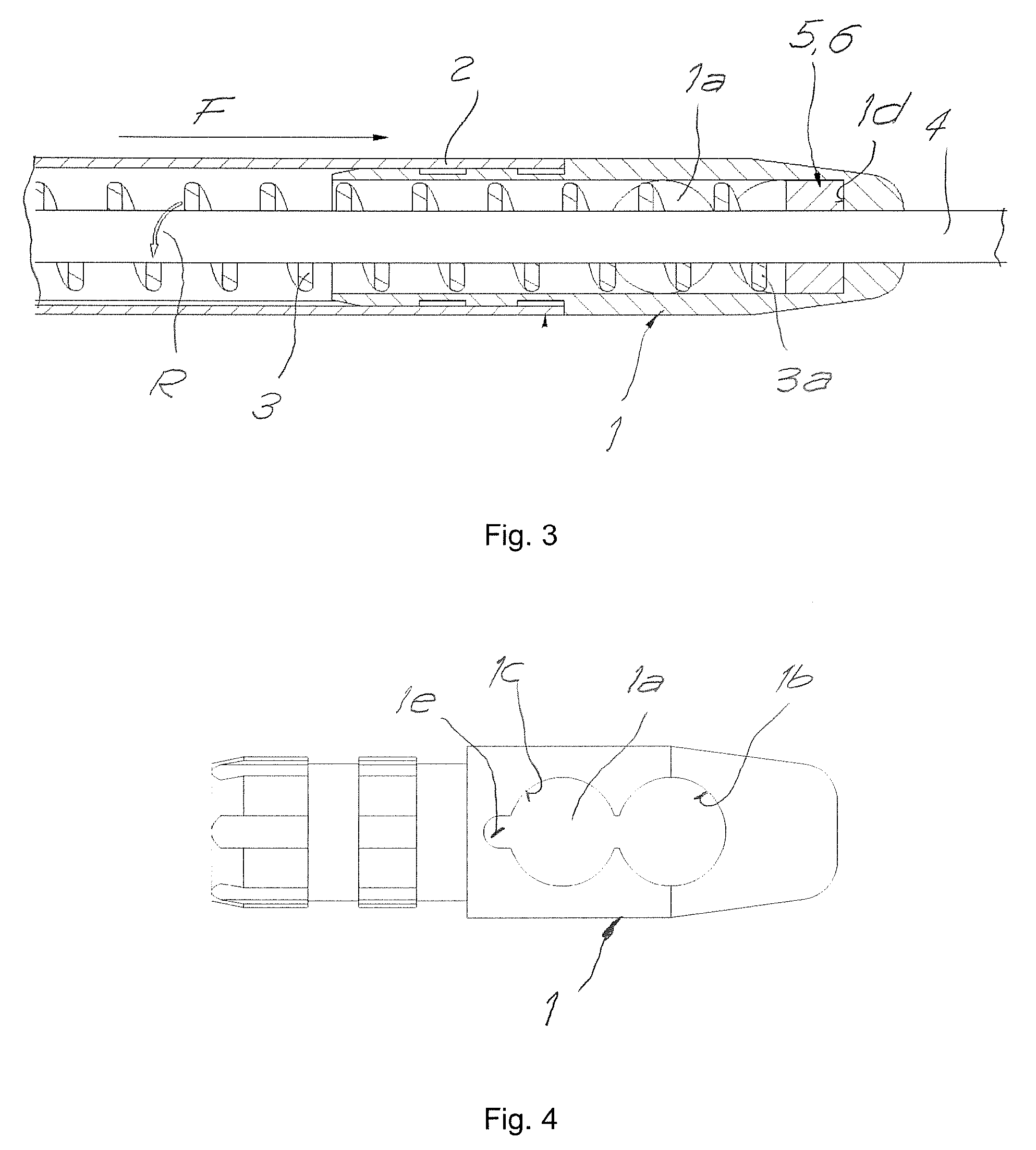 Catheter for aspirating, fragmenting and removing extractable material from blood vessels