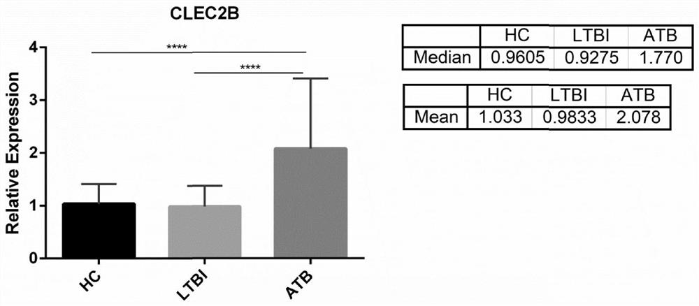Application of CLEC2B gene in differential diagnosis of tuberculosis