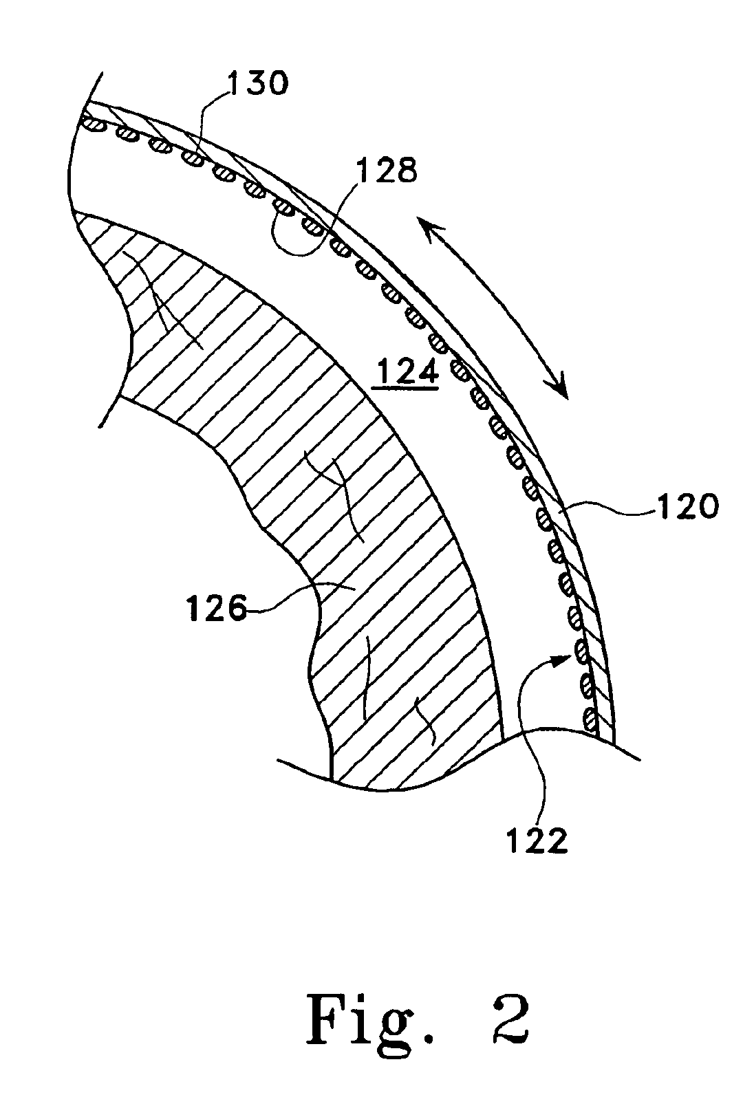 Pericardium reinforcing devices and methods of using them