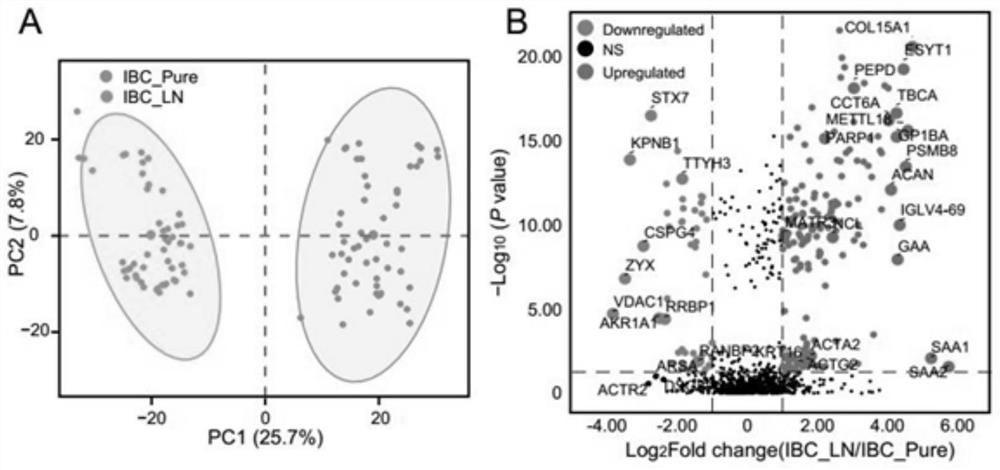 Exosome markers for diagnosing lymph node metastasis of invasive breast cancer and application of exosome markers