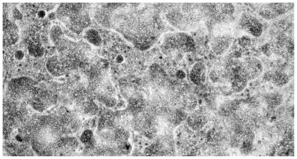 Culture medium and culture method for inducing differentiation of iPS (induced pluripotent stem) cells